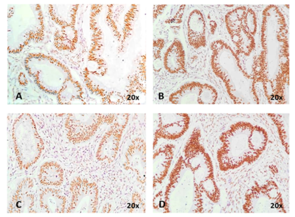 Diagnostics 11 00314 g006