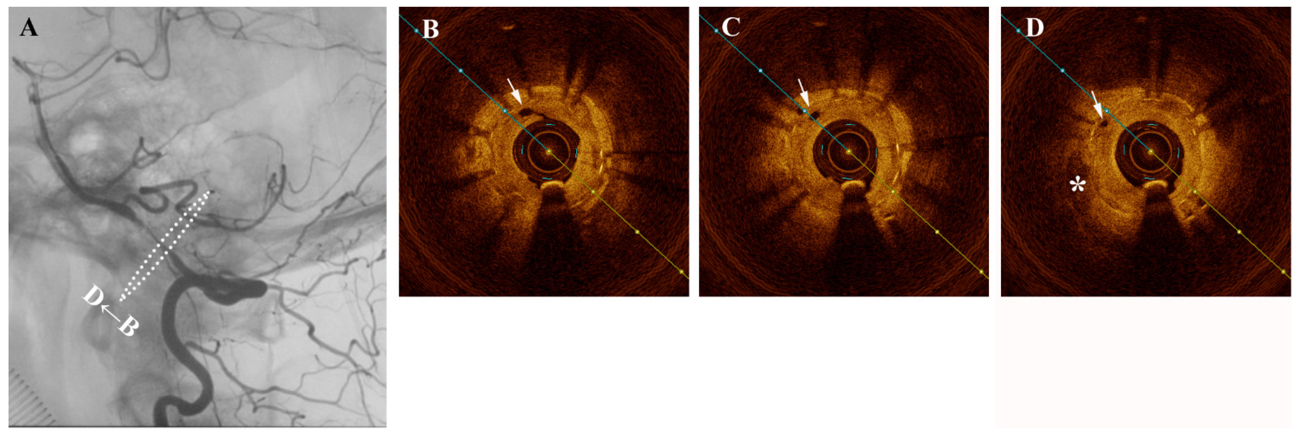 Diagnostics 11 00322 g001