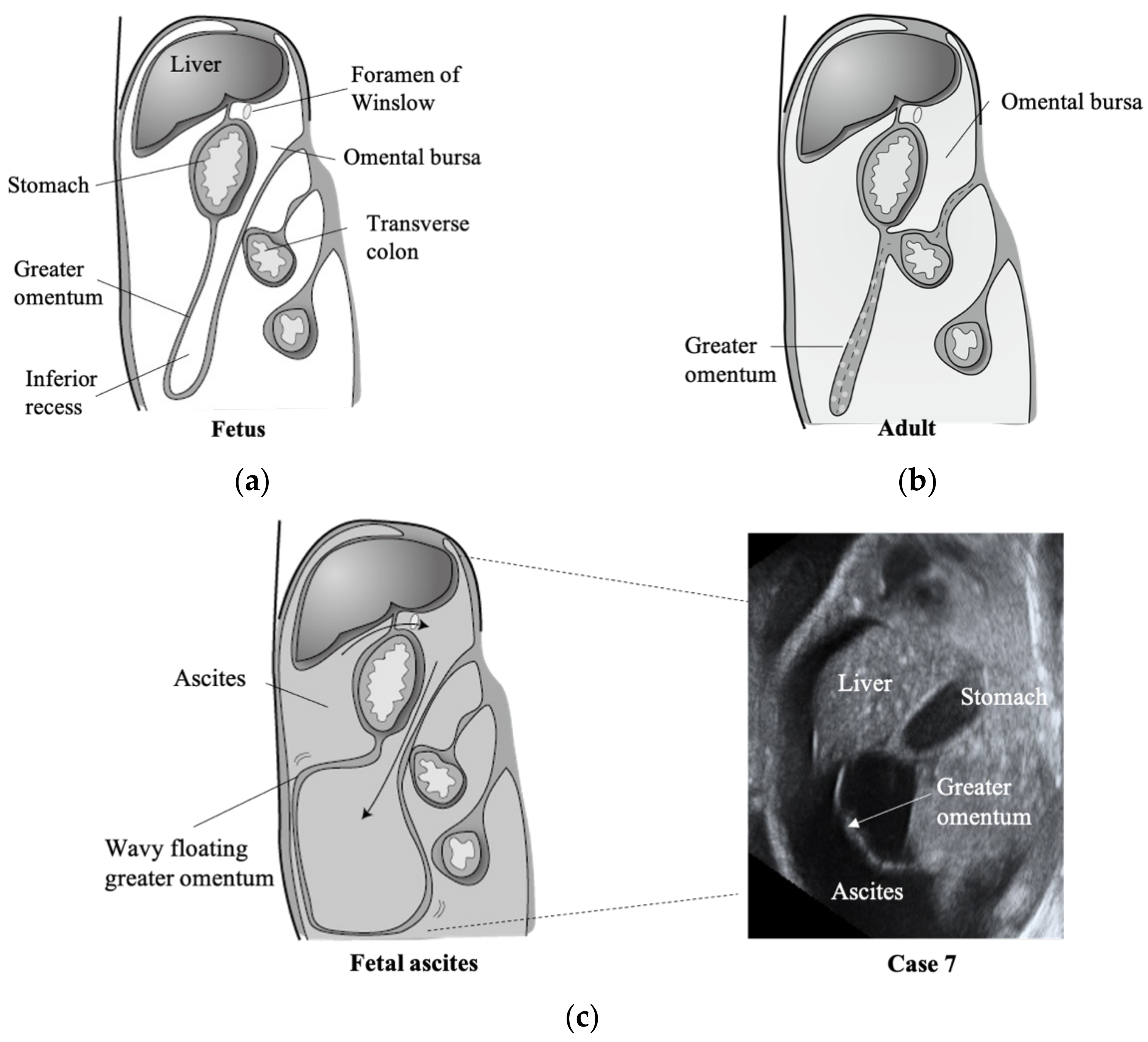 Diagnostics 11 00326 g002