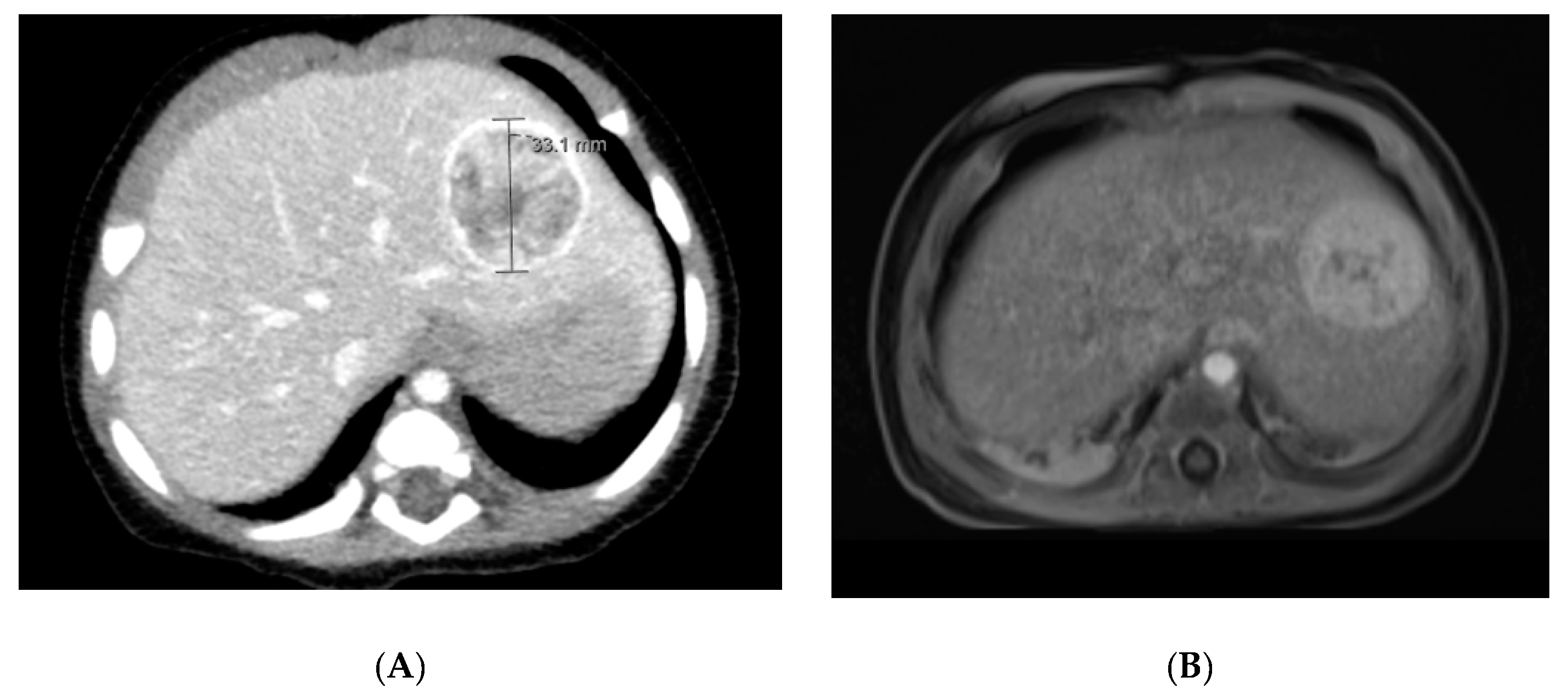 Diagnostics 11 00333 g001