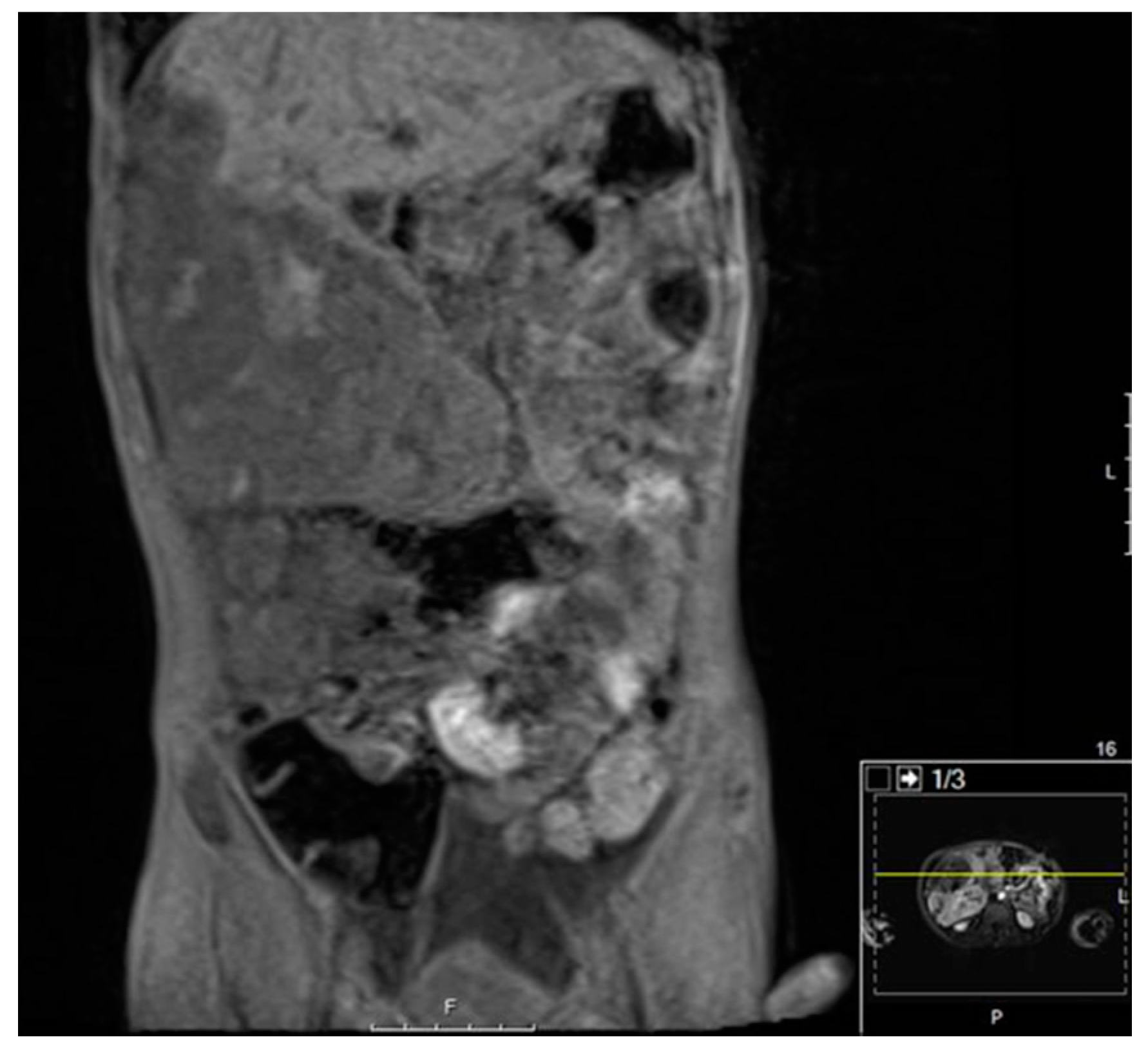 Diagnostics 11 00333 g005