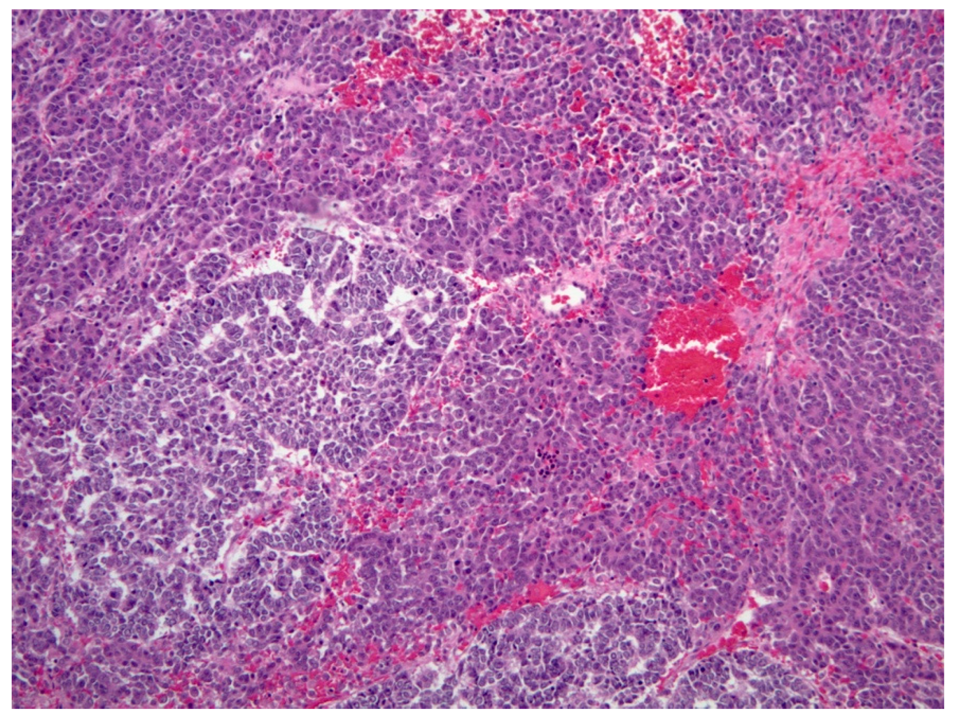 Diagnostics 11 00333 g006