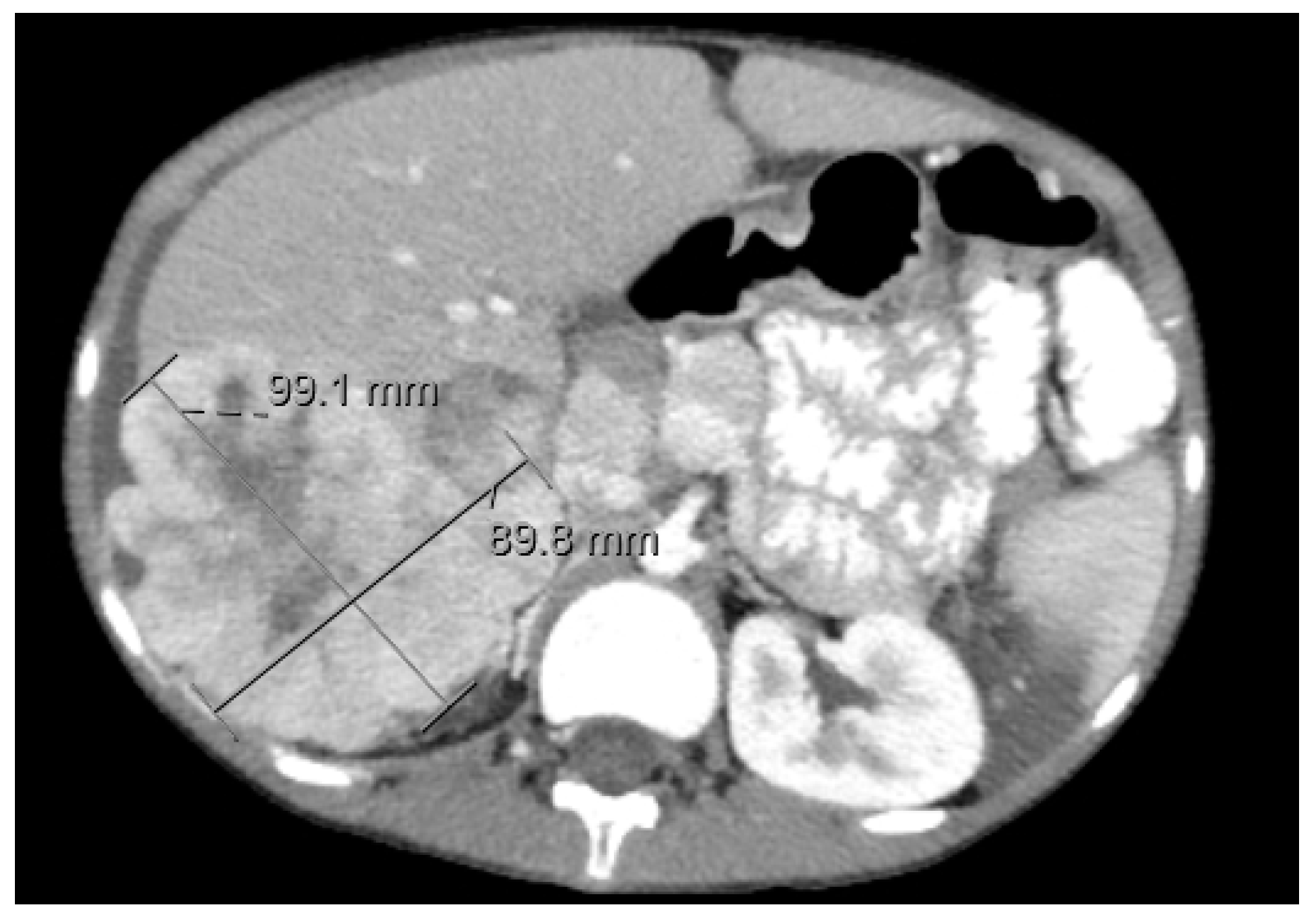 Diagnostics 11 00333 g010