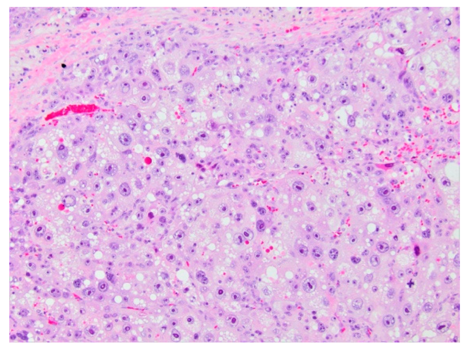 Diagnostics 11 00333 g011