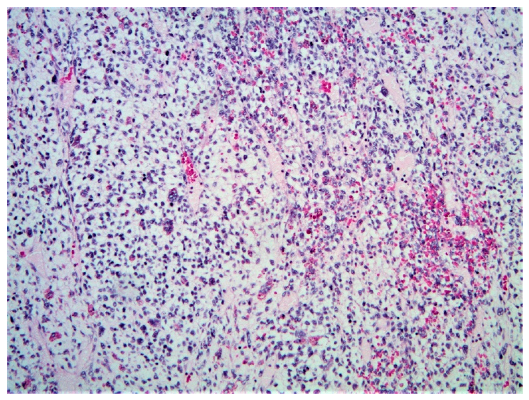 Diagnostics 11 00333 g013