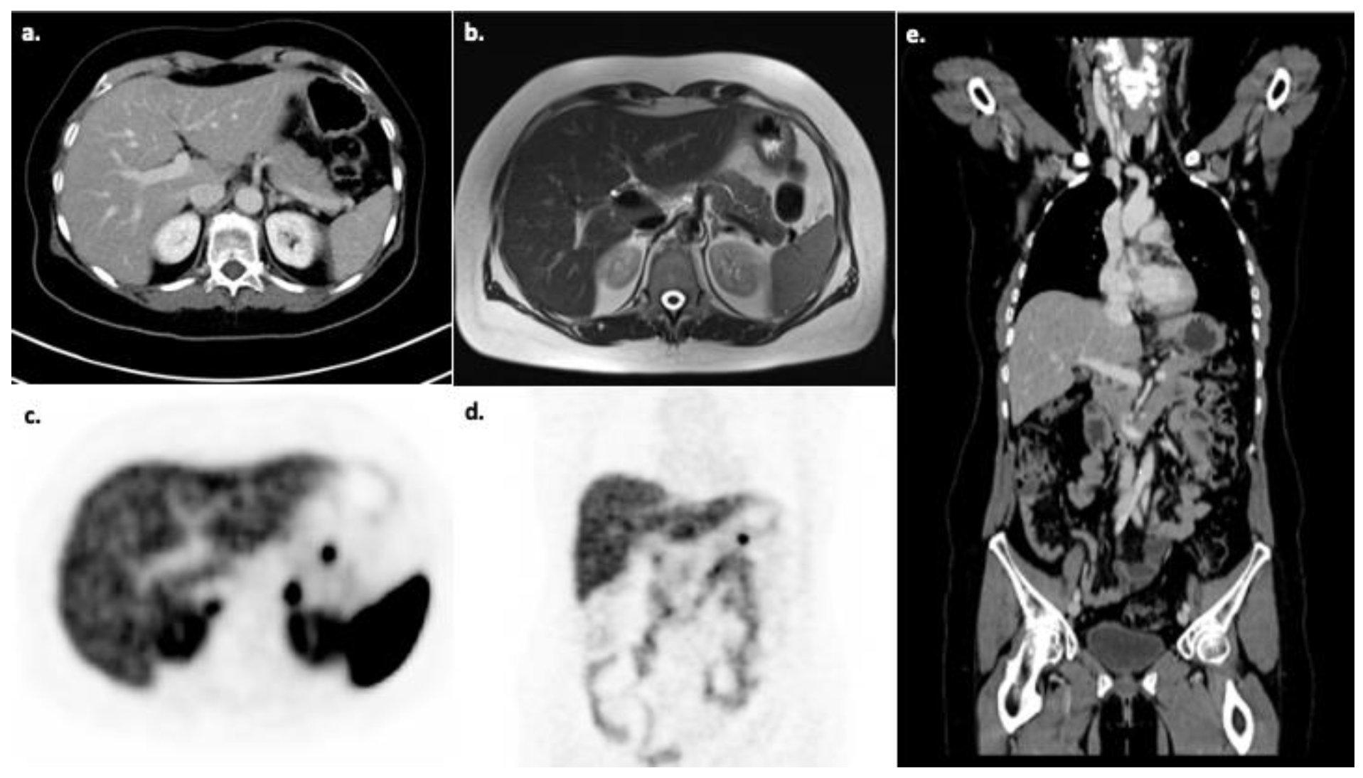Diagnostics 11 00334 g005
