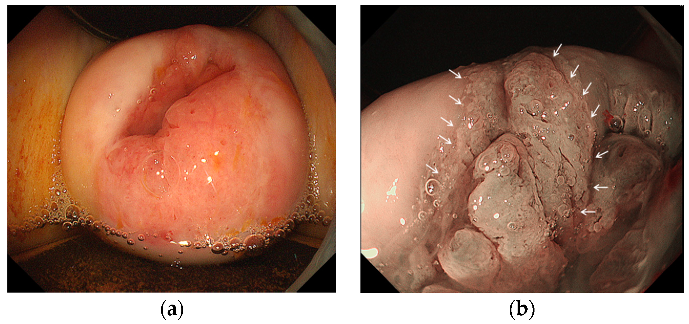 Diagnostics 11 00360 g003