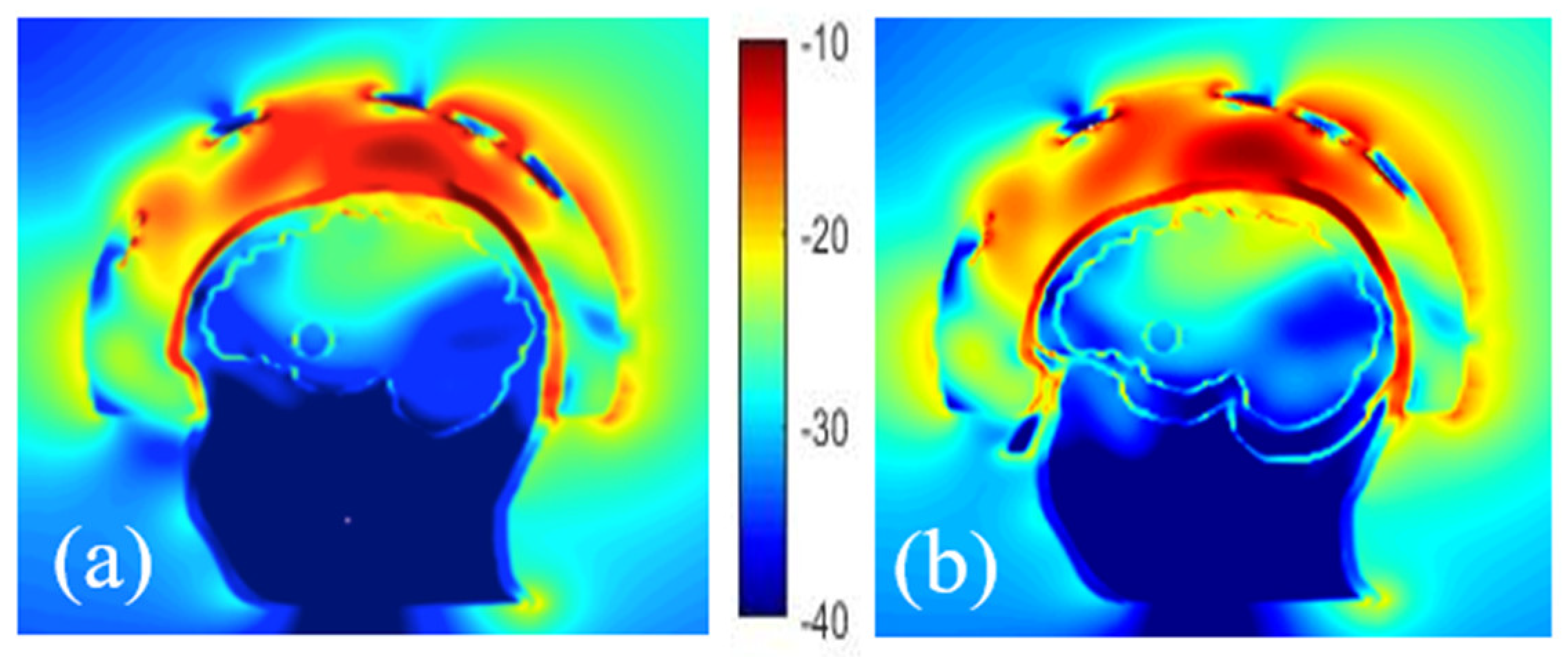 Diagnostics 11 00376 g008