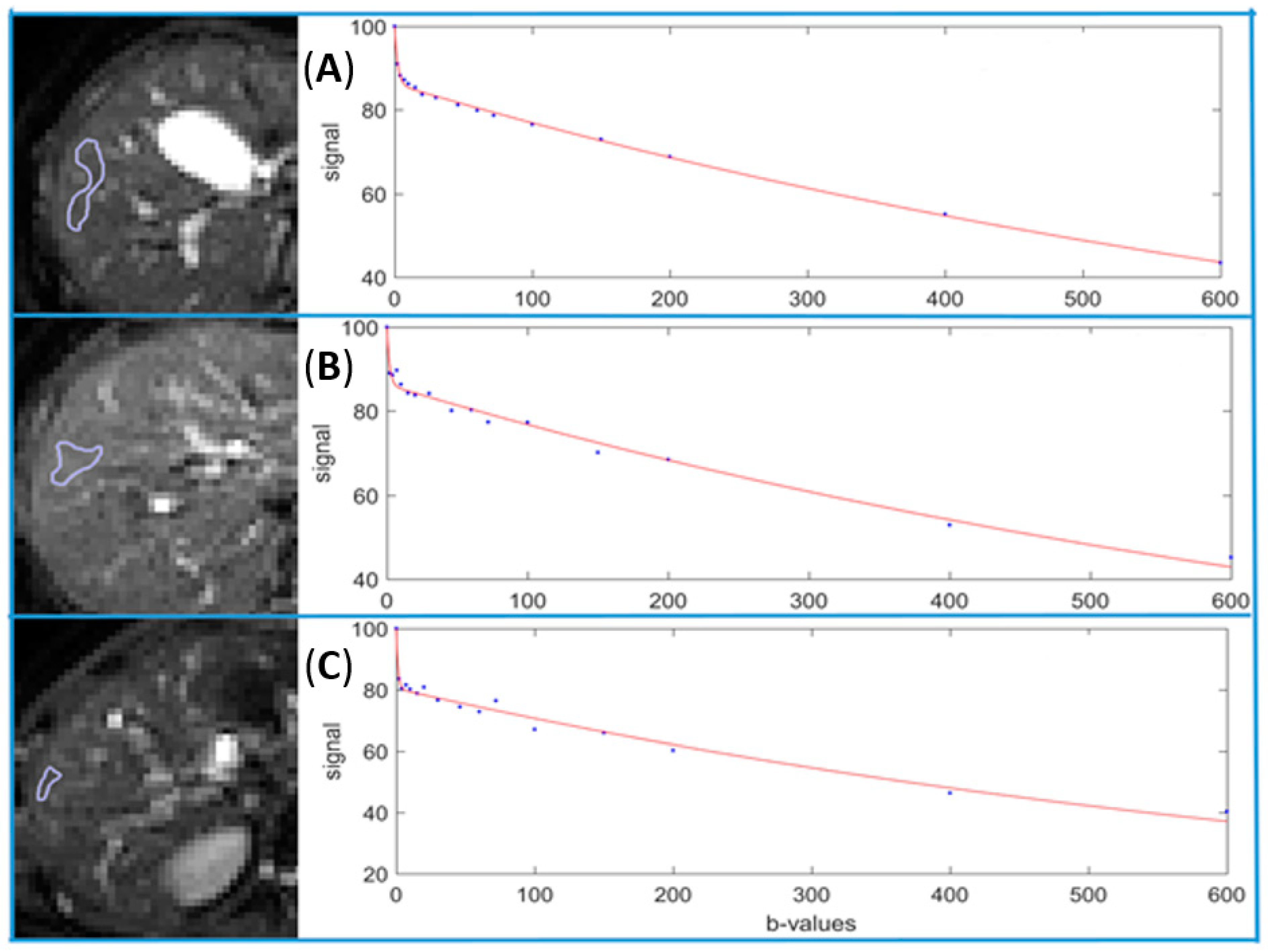 Diagnostics 11 00379 g004
