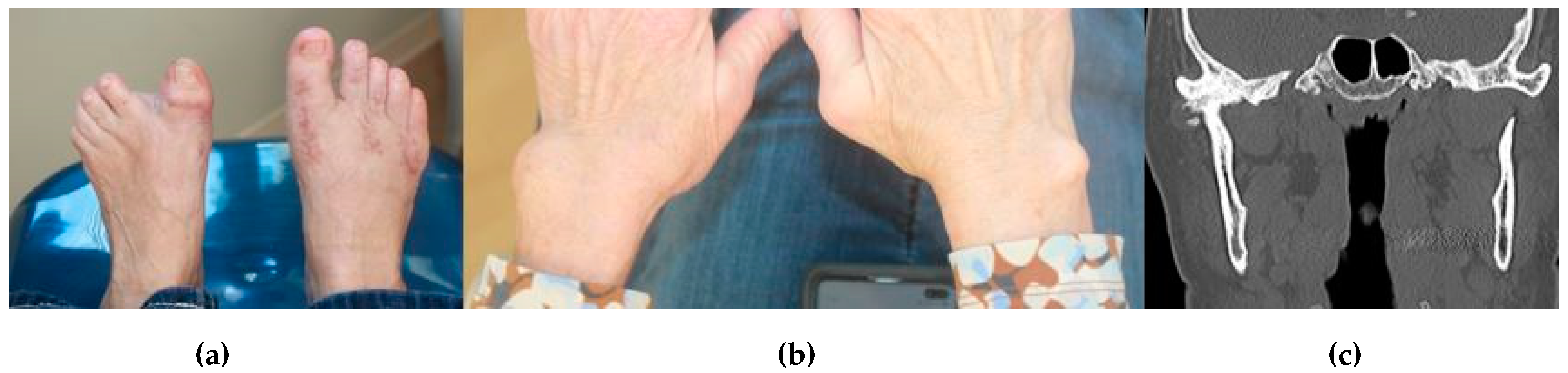 Diagnostics 11 00409 g002