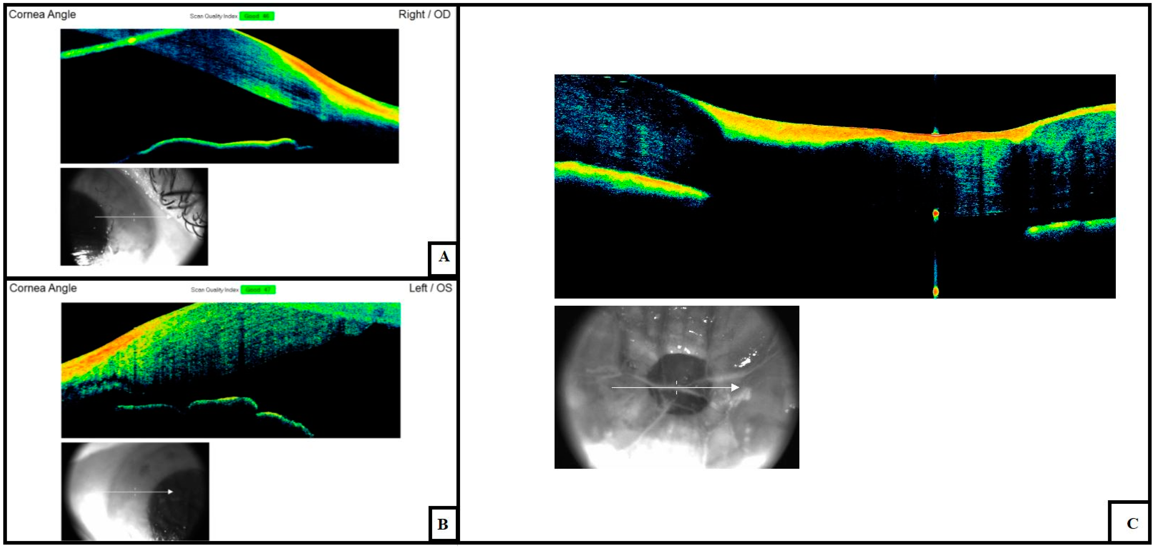 Diagnostics 11 00413 g004