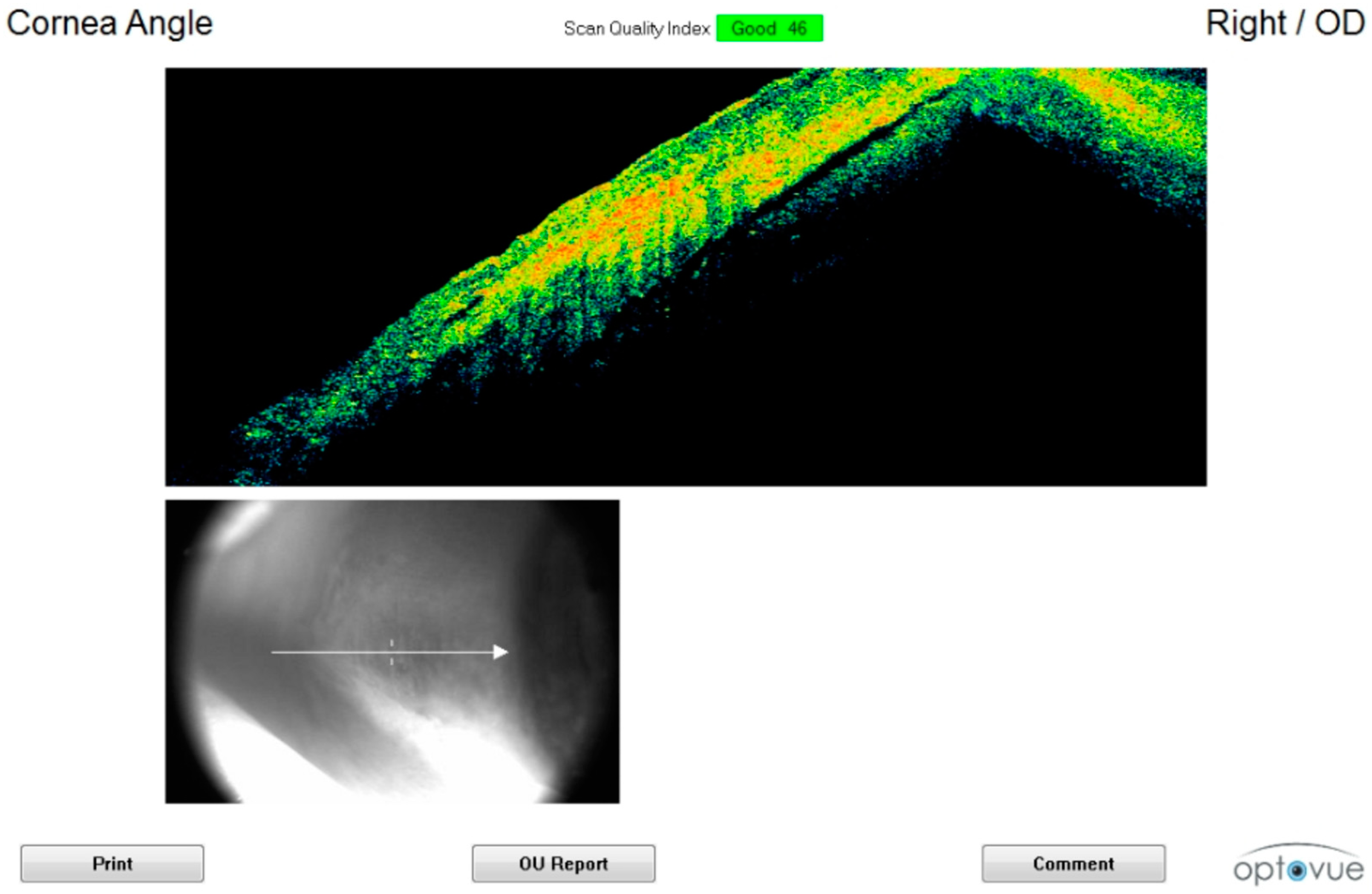 Diagnostics 11 00413 g005