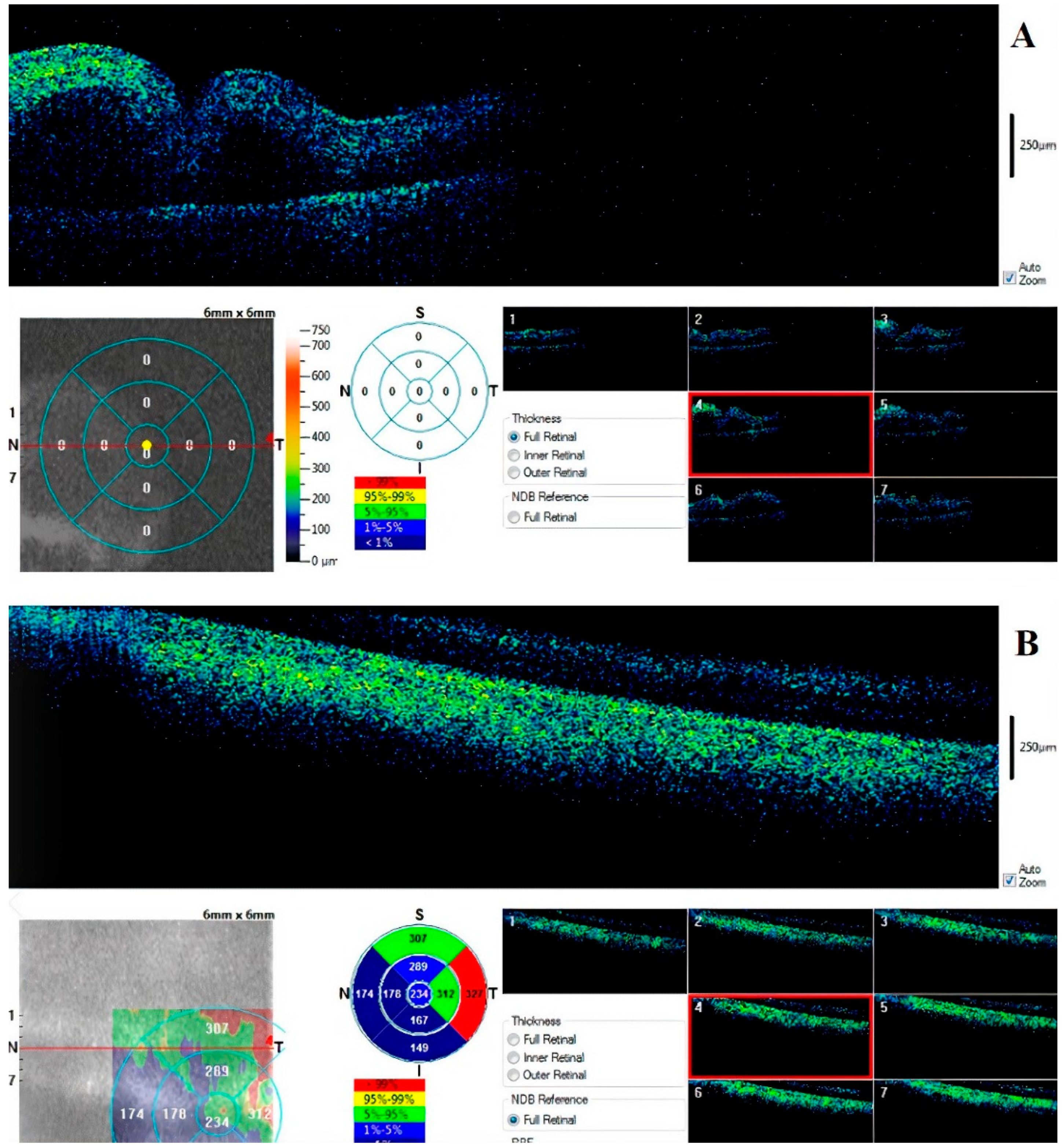 Diagnostics 11 00413 g006