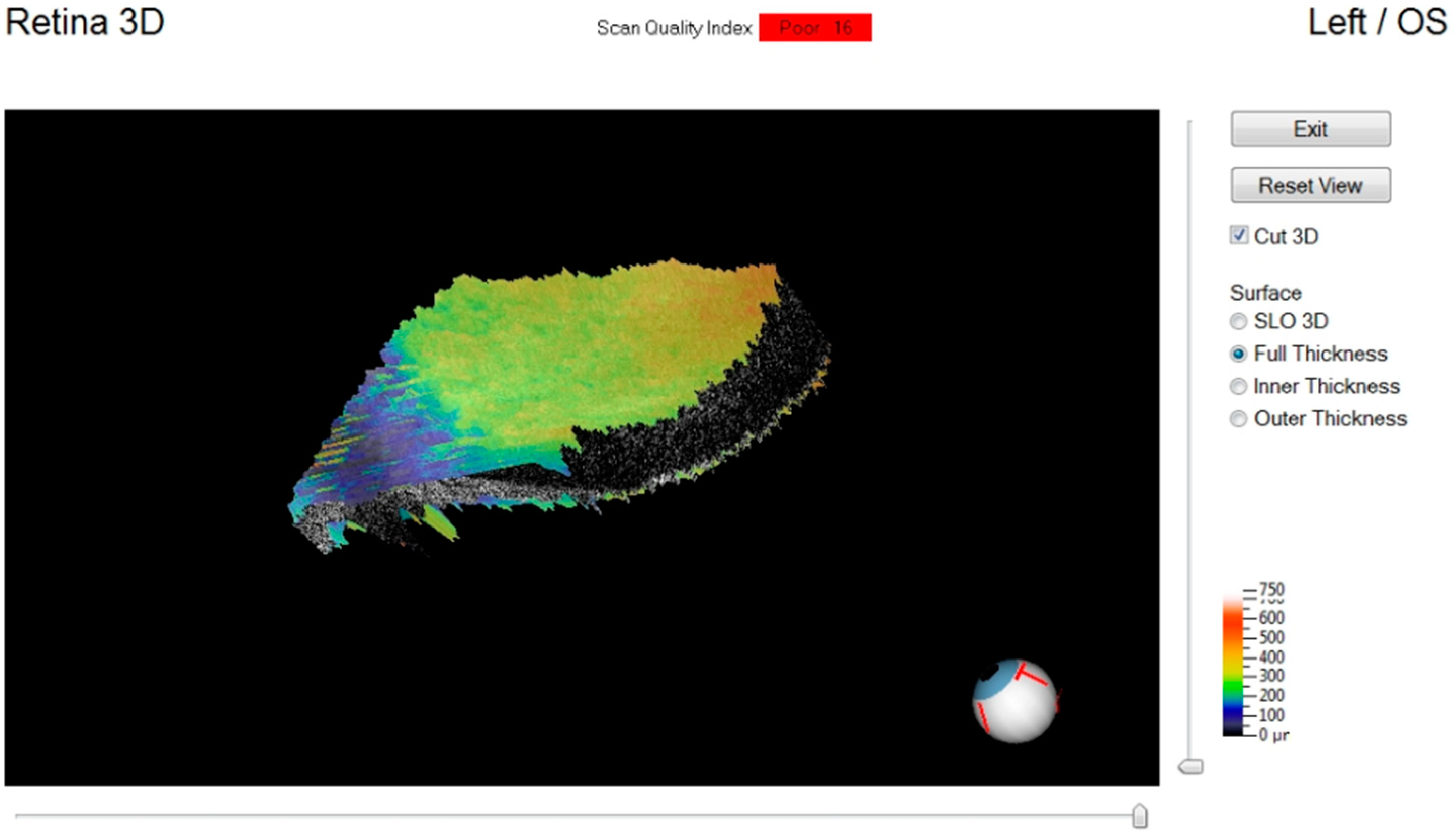Diagnostics 11 00413 g007
