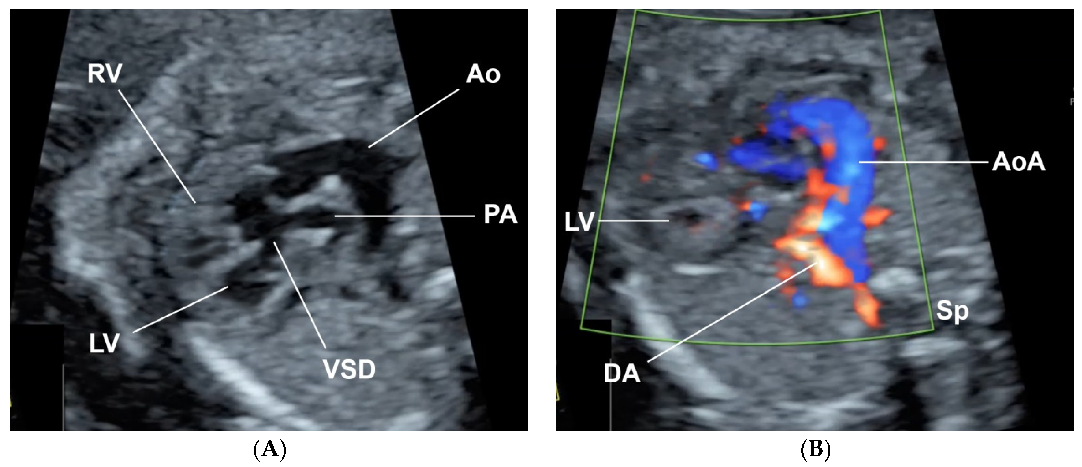 Diagnostics 11 00415 g001 Diagnostics 11 00415 g001