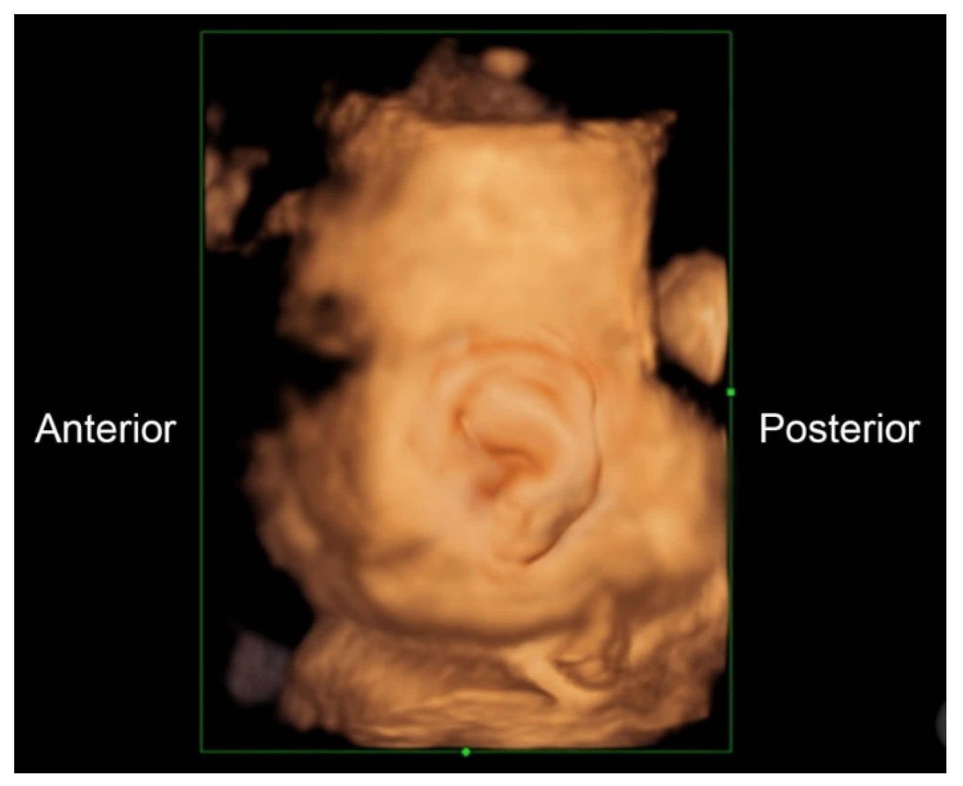 Diagnostics 11 00415 g003 Diagnostics 11 00415 g003