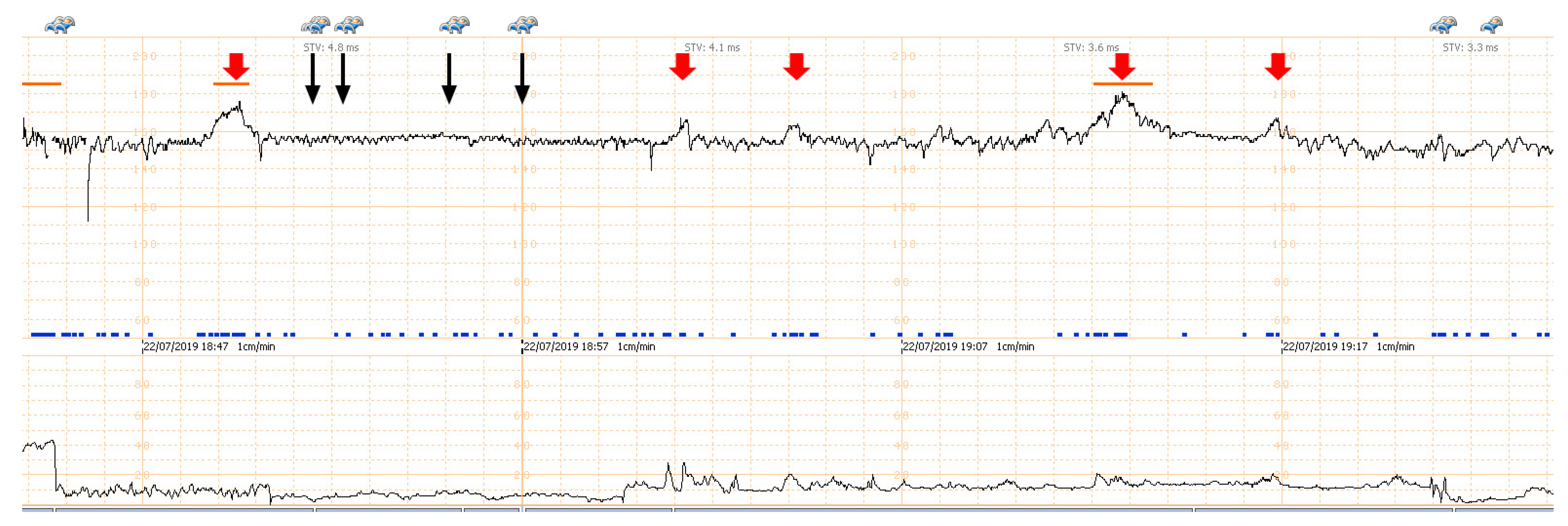 Diagnostics 11 00415 g004 Diagnostics 11 00415 g004
