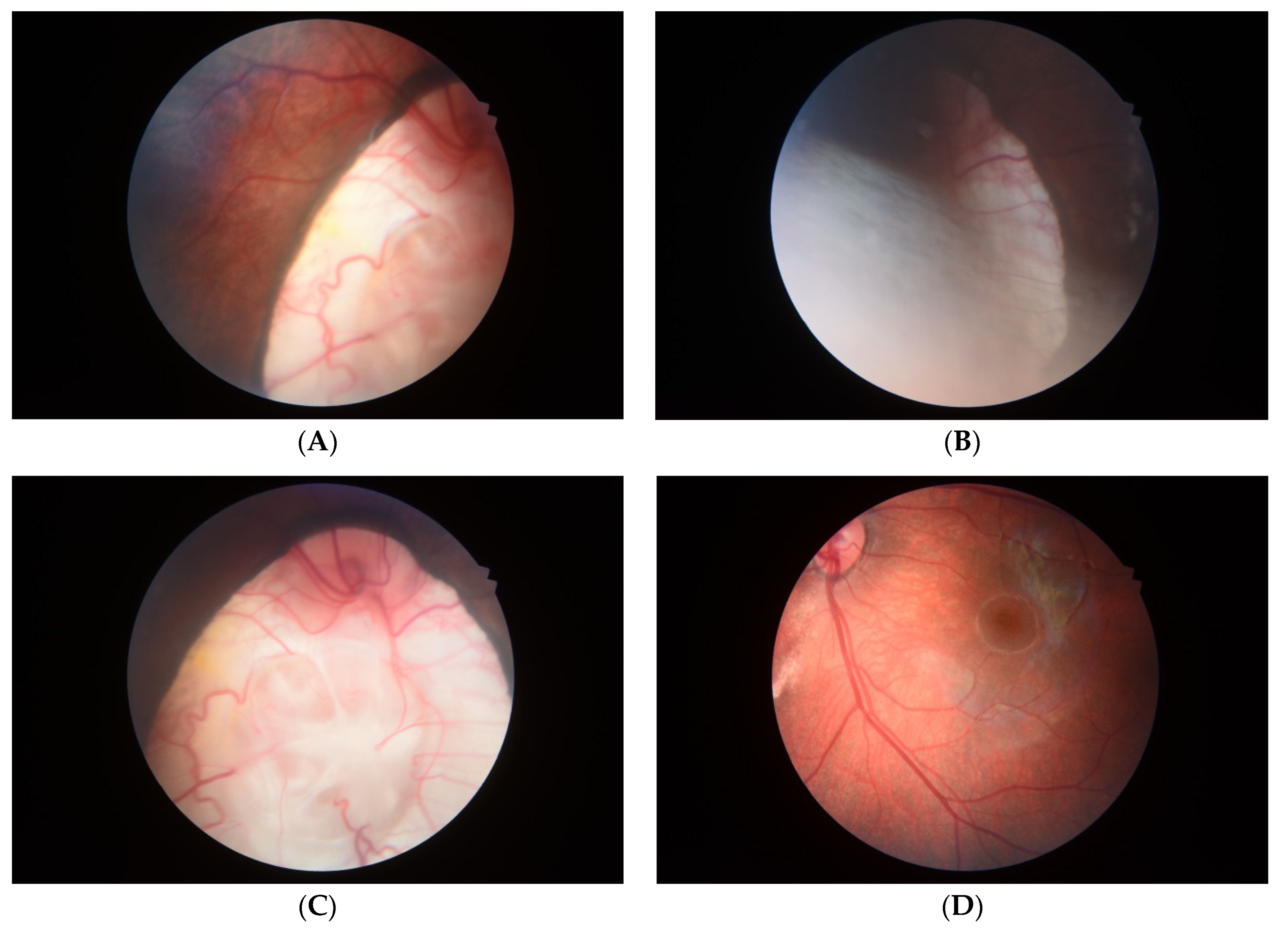 Diagnostics 11 00415 g006 Diagnostics 11 00415 g006