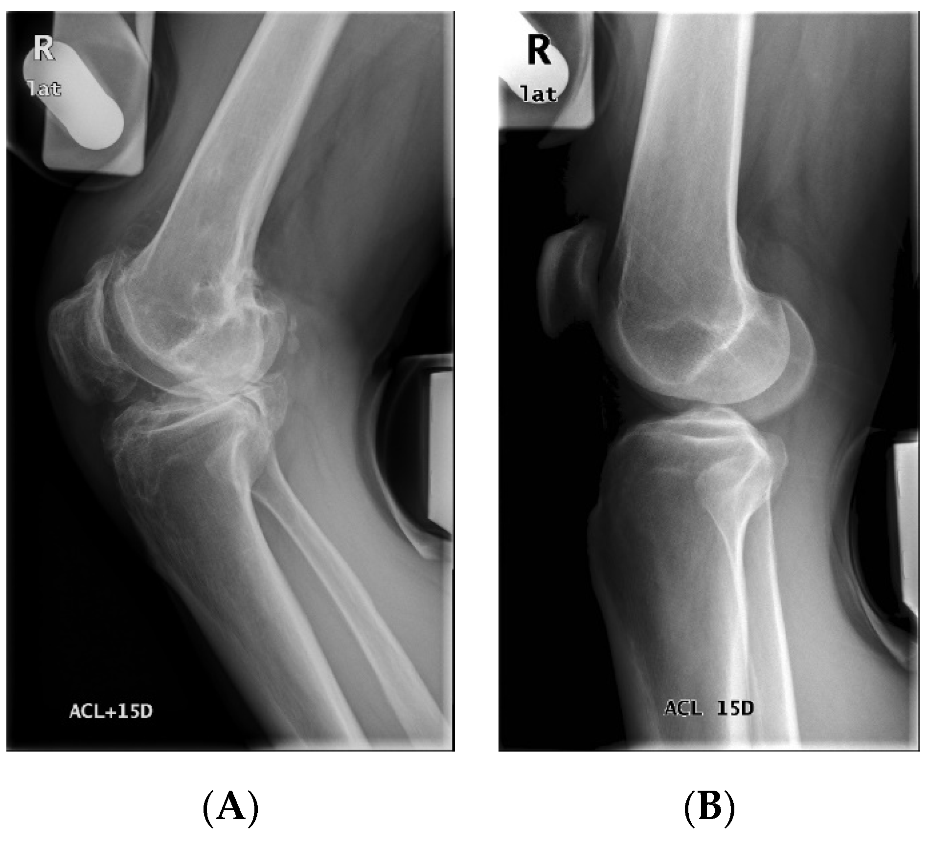 Diagnostics 11 00419 g0a1
