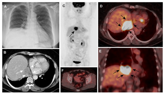 Diagnostics 11 00422 g001