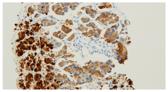 Diagnostics 11 00422 g002