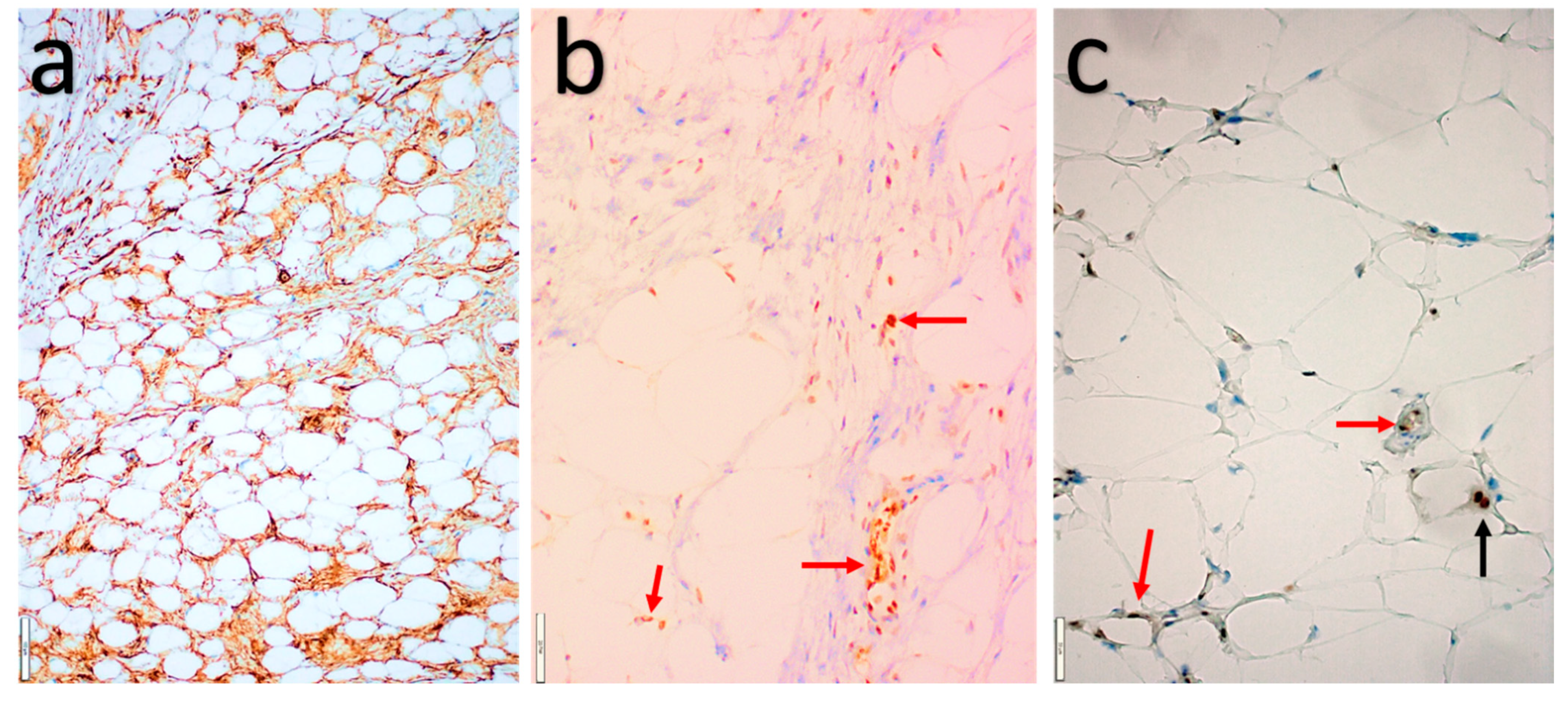 Diagnostics 11 00430 g004 Diagnostics 11 00430 g004