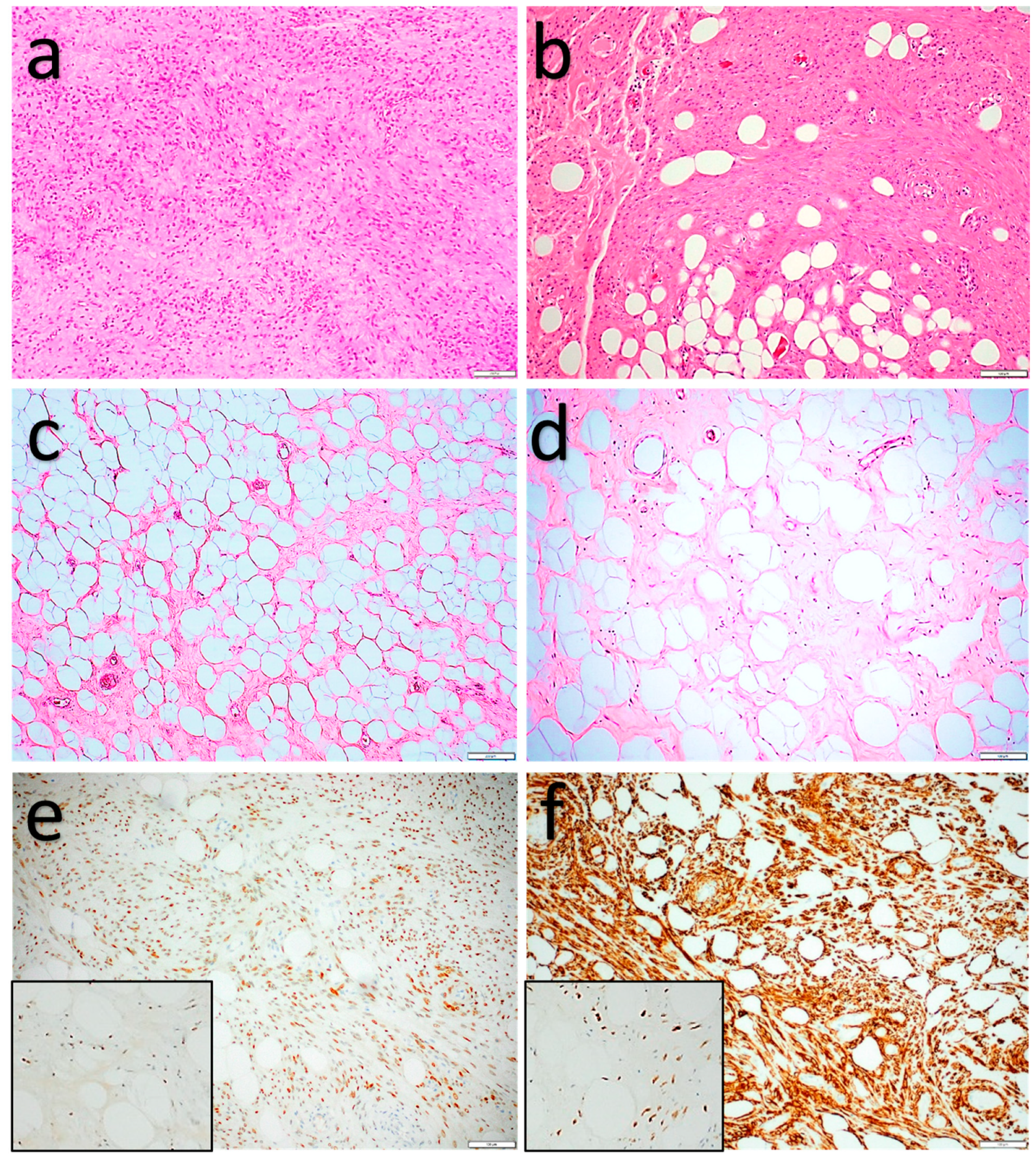 Diagnostics 11 00430 g006 Diagnostics 11 00430 g006