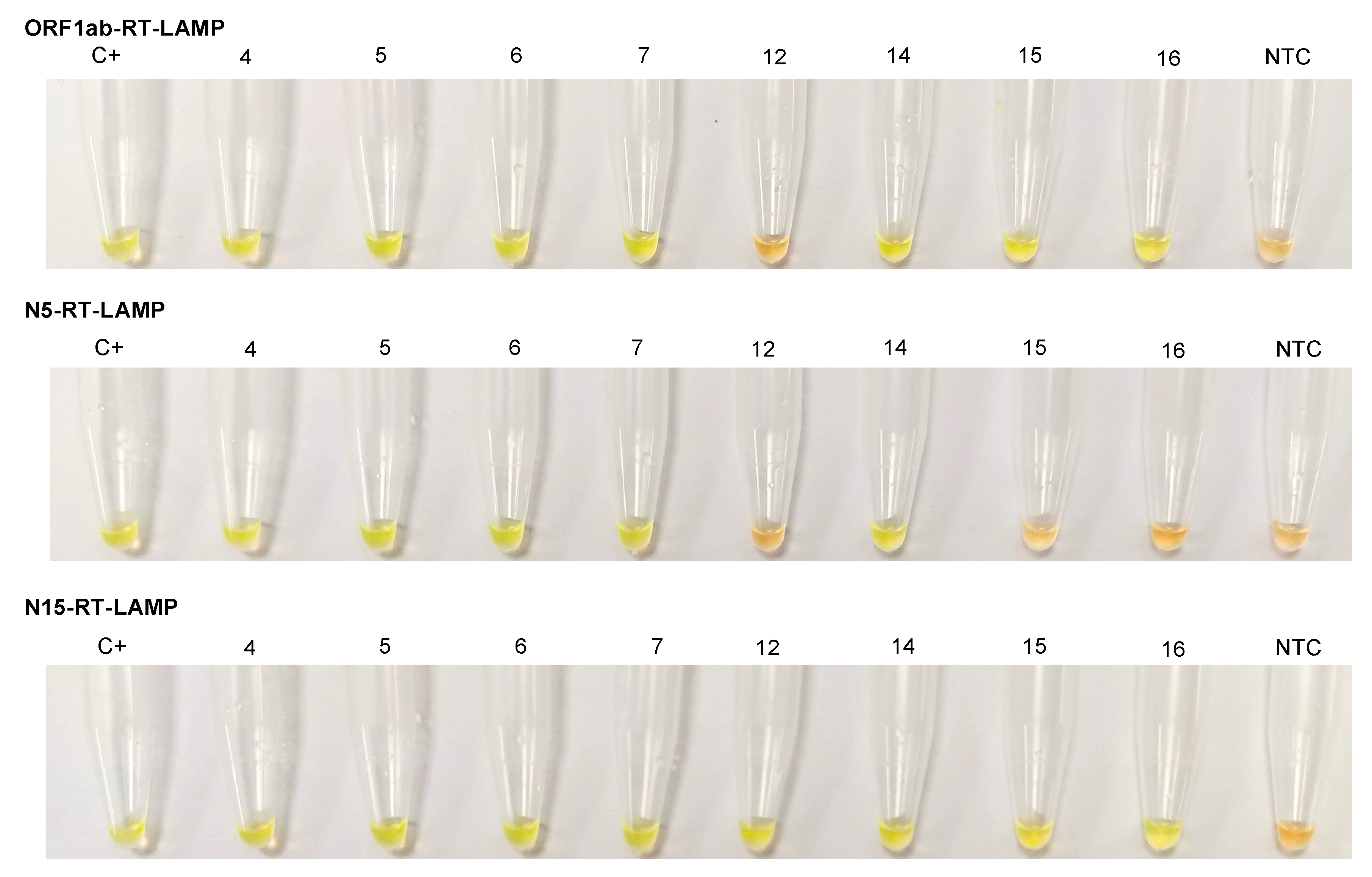 Diagnostics 11 00438 g005