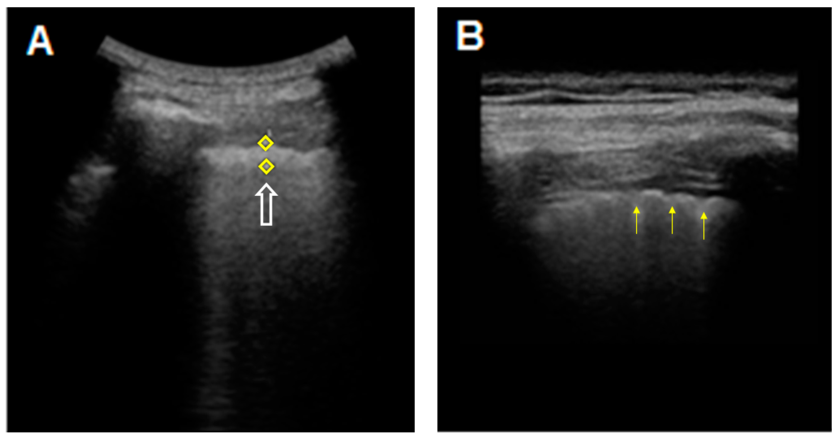 Diagnostics 11 00439 g002