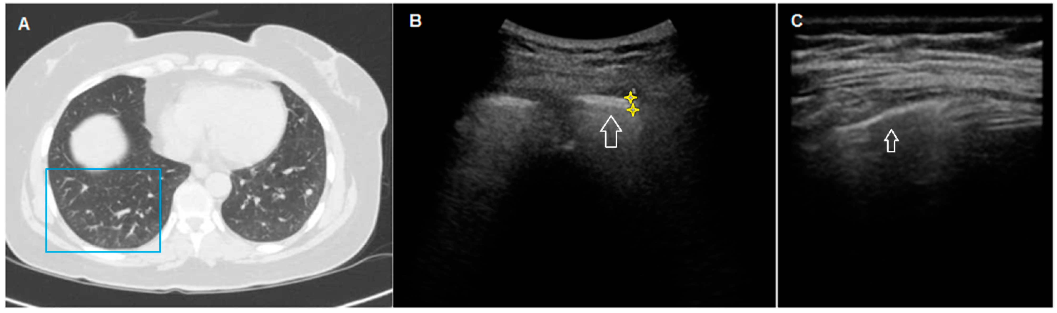 Diagnostics 11 00439 g003