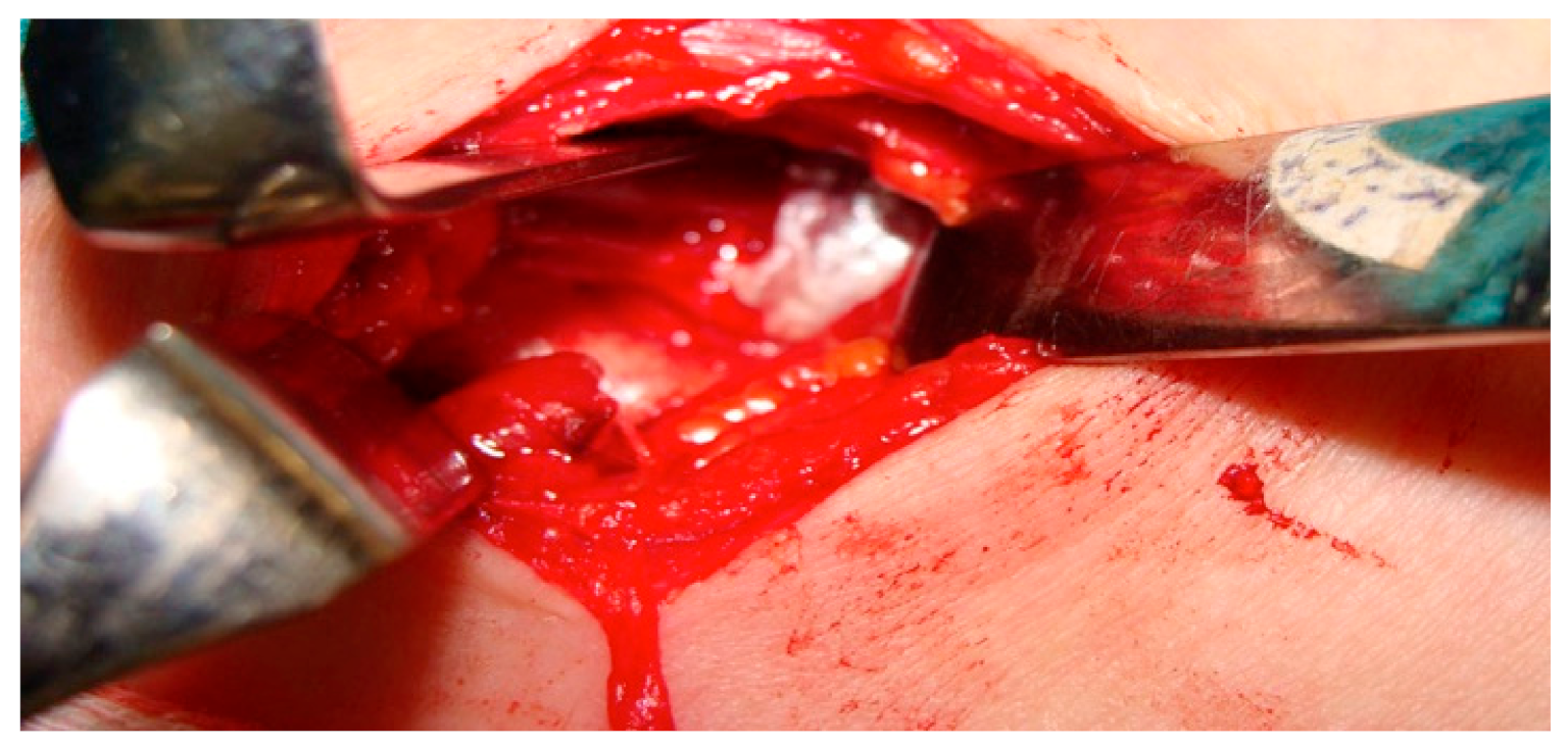 Diagnostics 11 00450 g003