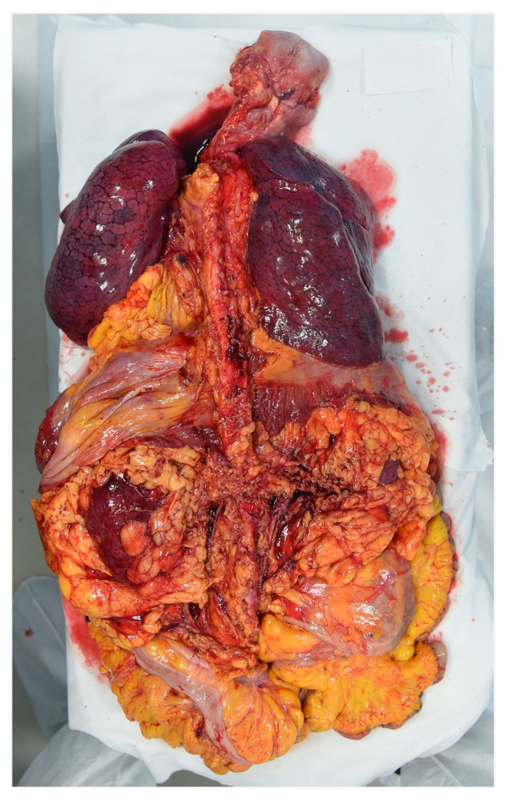 Diagnostics 11 00457 g002 Diagnostics 11 00457 g002