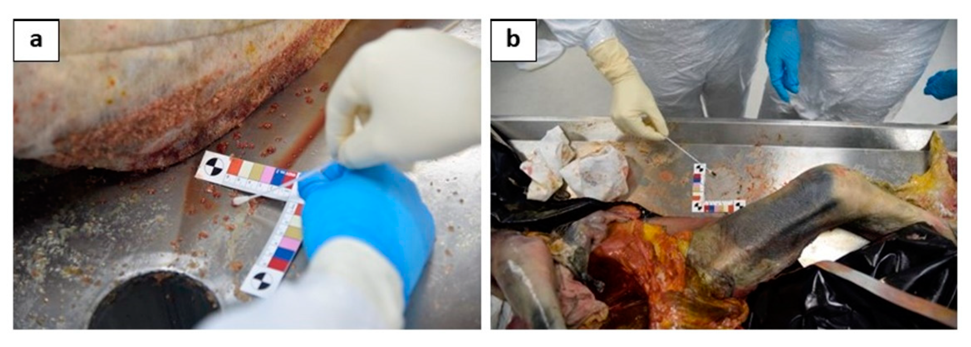 Diagnostics 11 00457 g003 Diagnostics 11 00457 g003