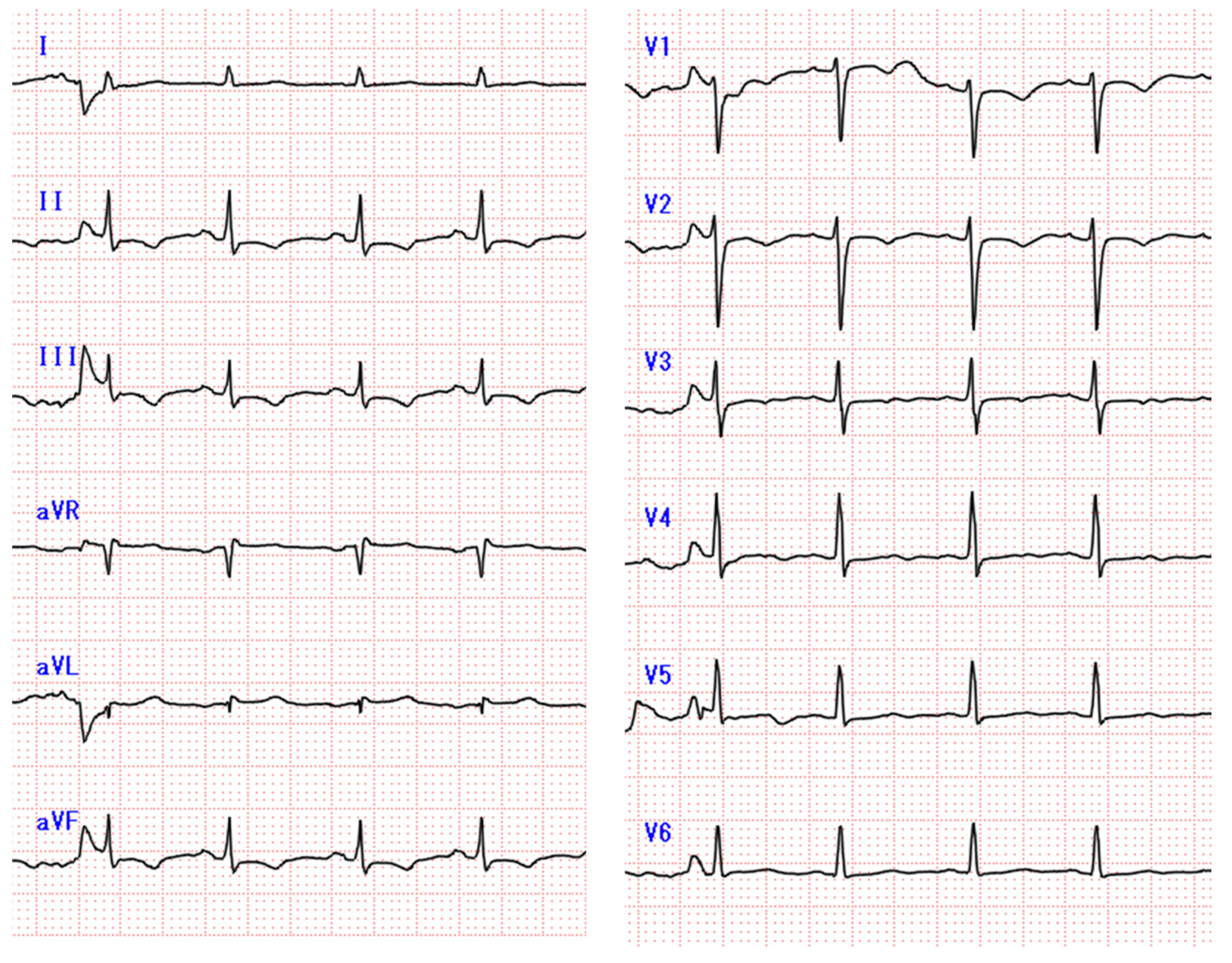 Diagnostics 11 00460 g004 Diagnostics 11 00460 g004