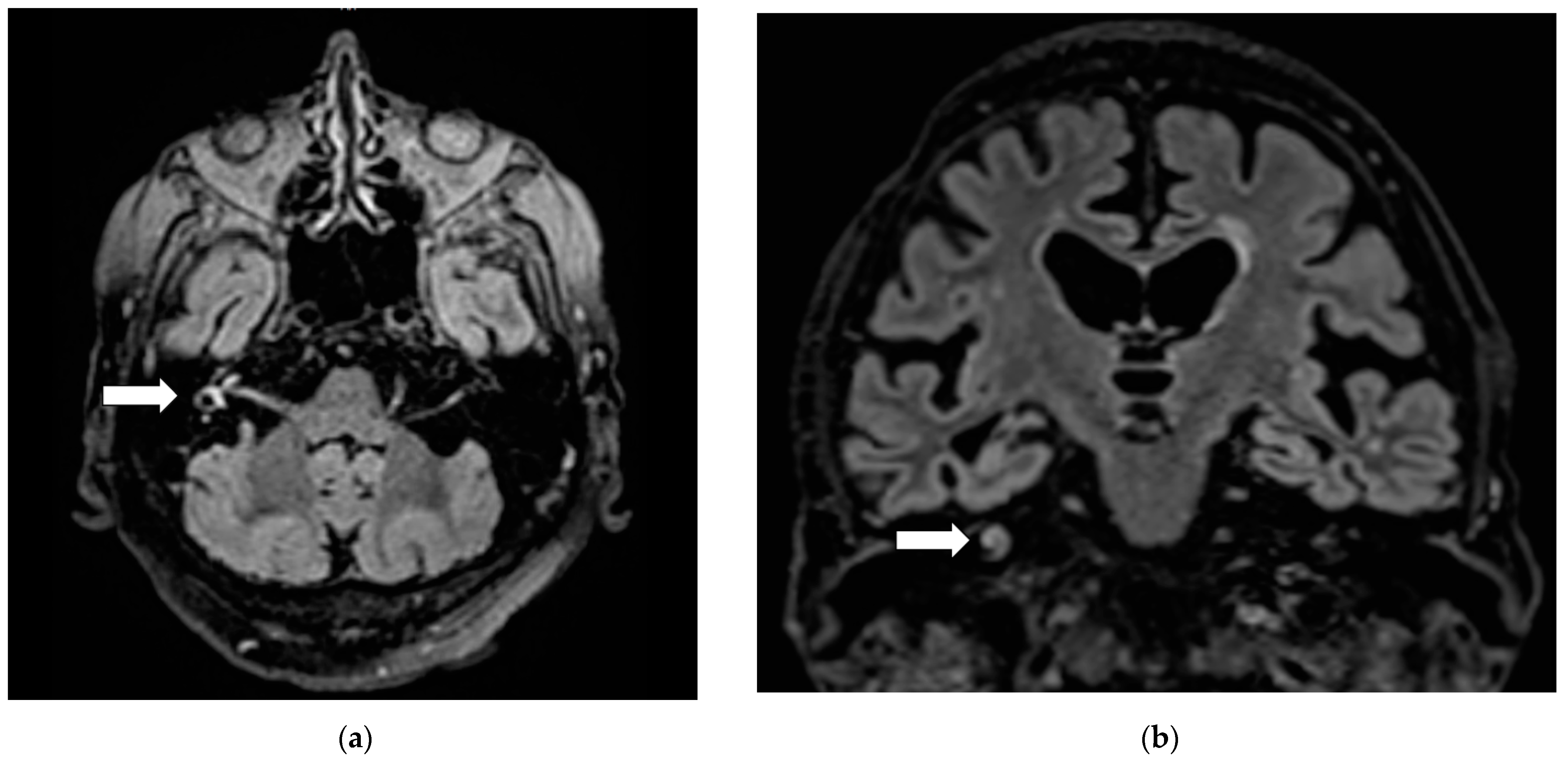 Diagnostics 11 00482 g001 Diagnostics 11 00482 g001