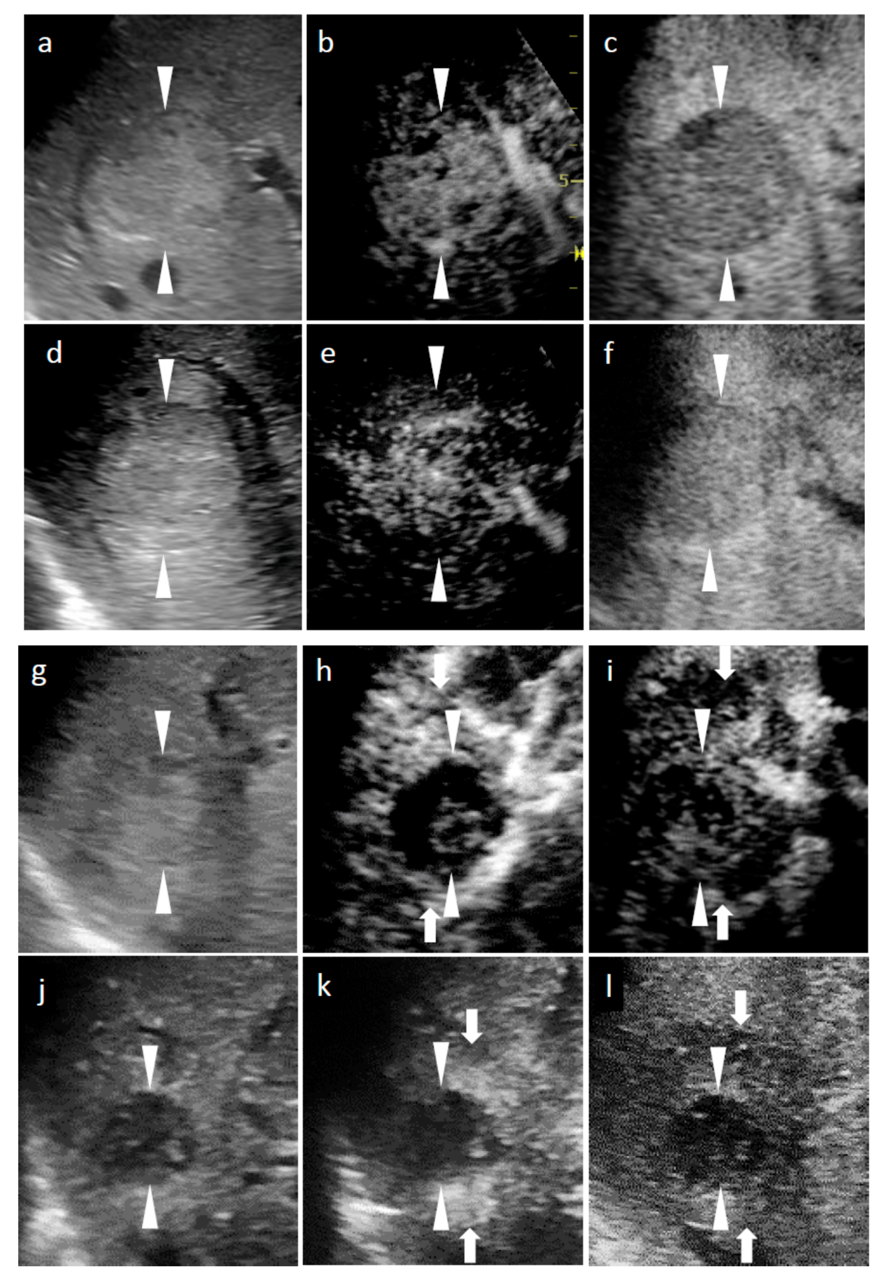 Diagnostics 11 00486 g001