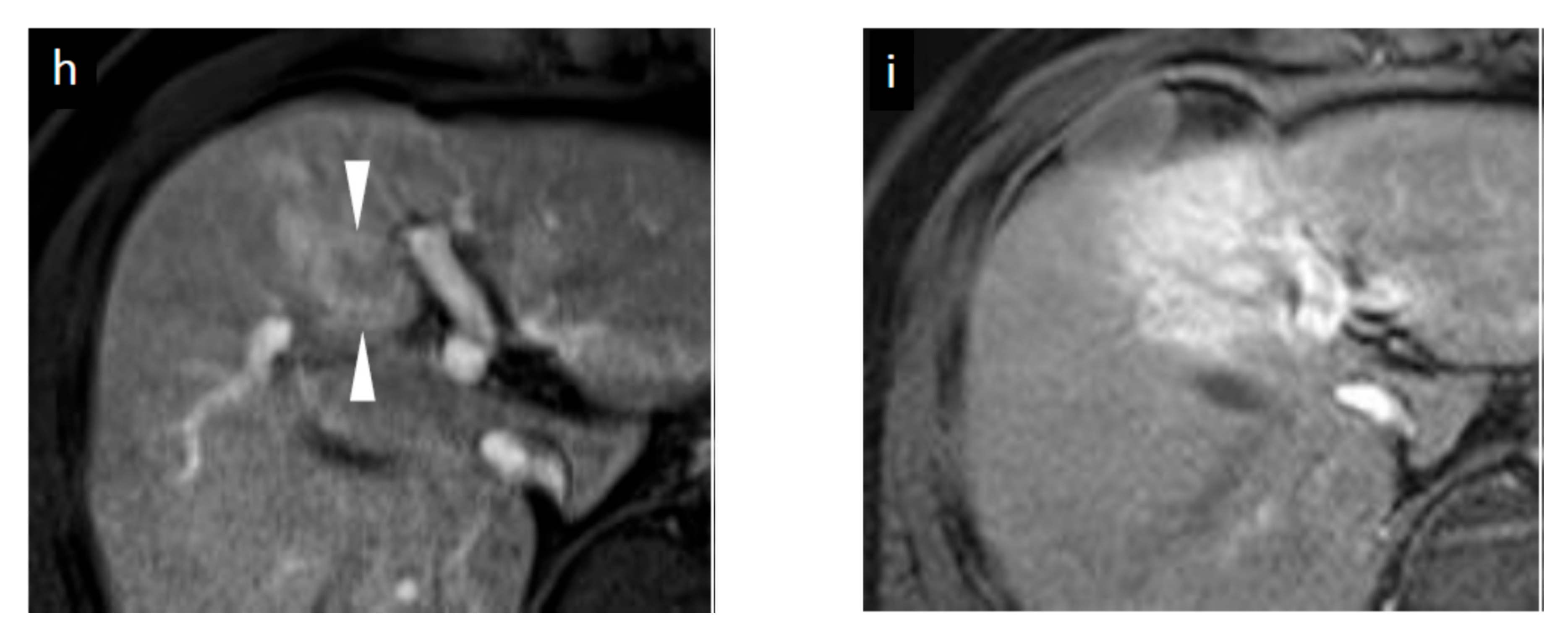 Diagnostics 11 00486 g002b
