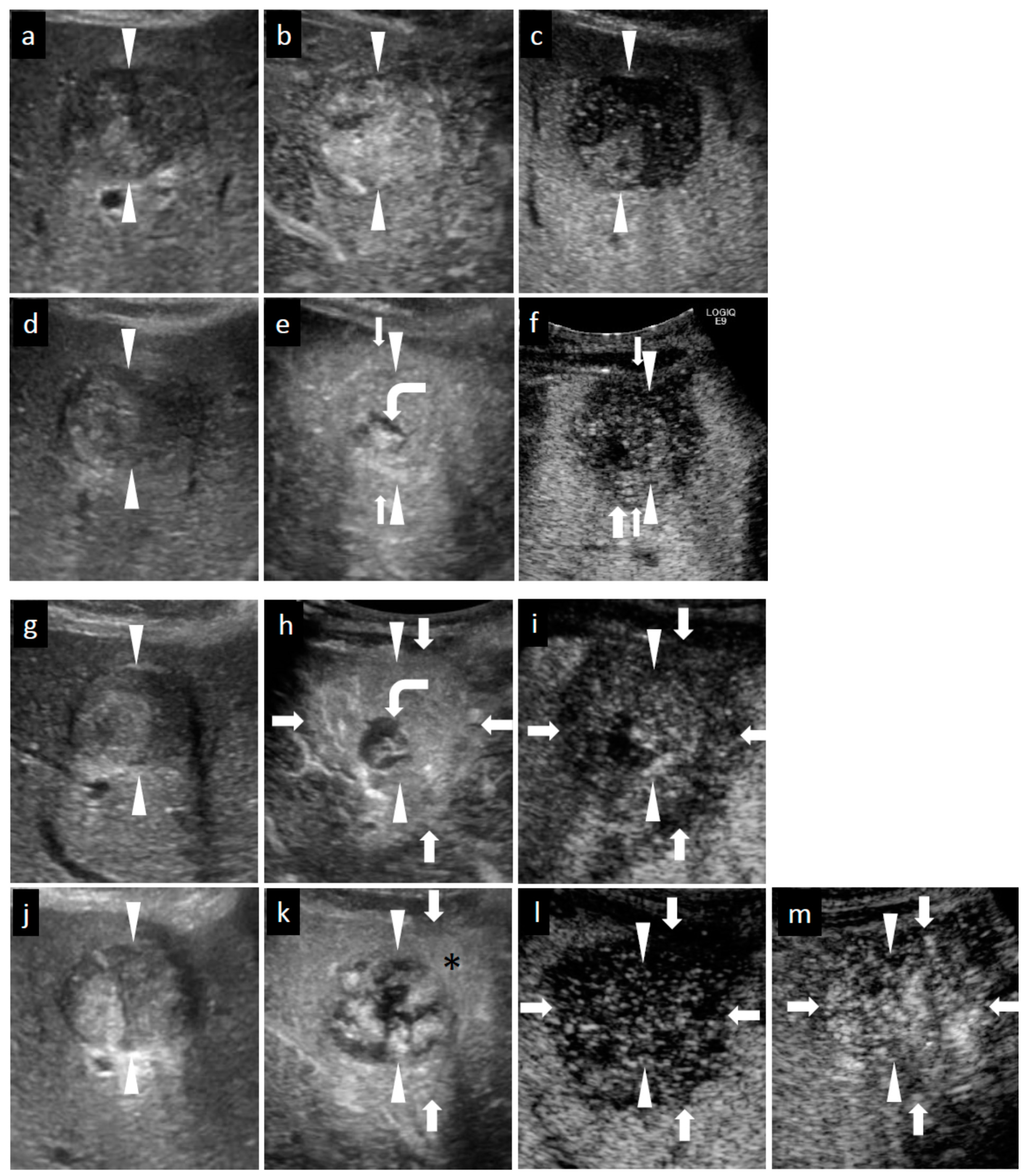 Diagnostics 11 00486 g003a