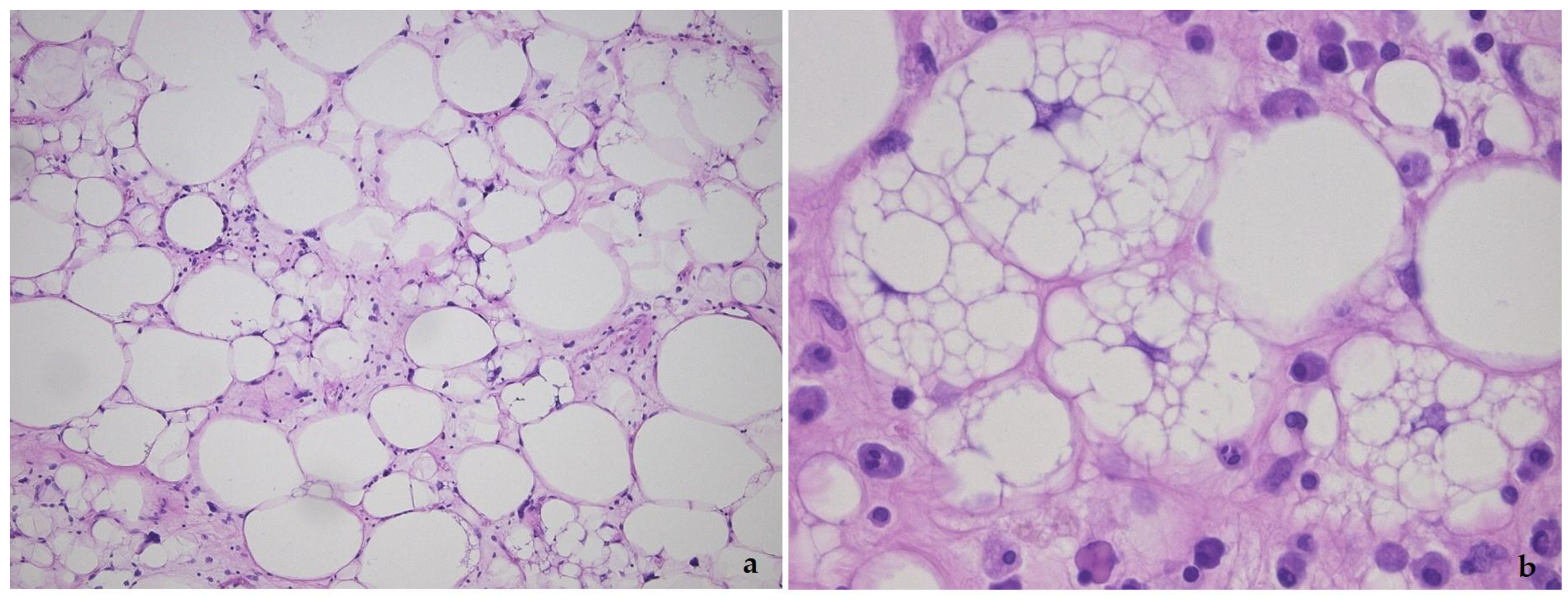 Diagnostics 11 00496 g001 Diagnostics 11 00496 g001