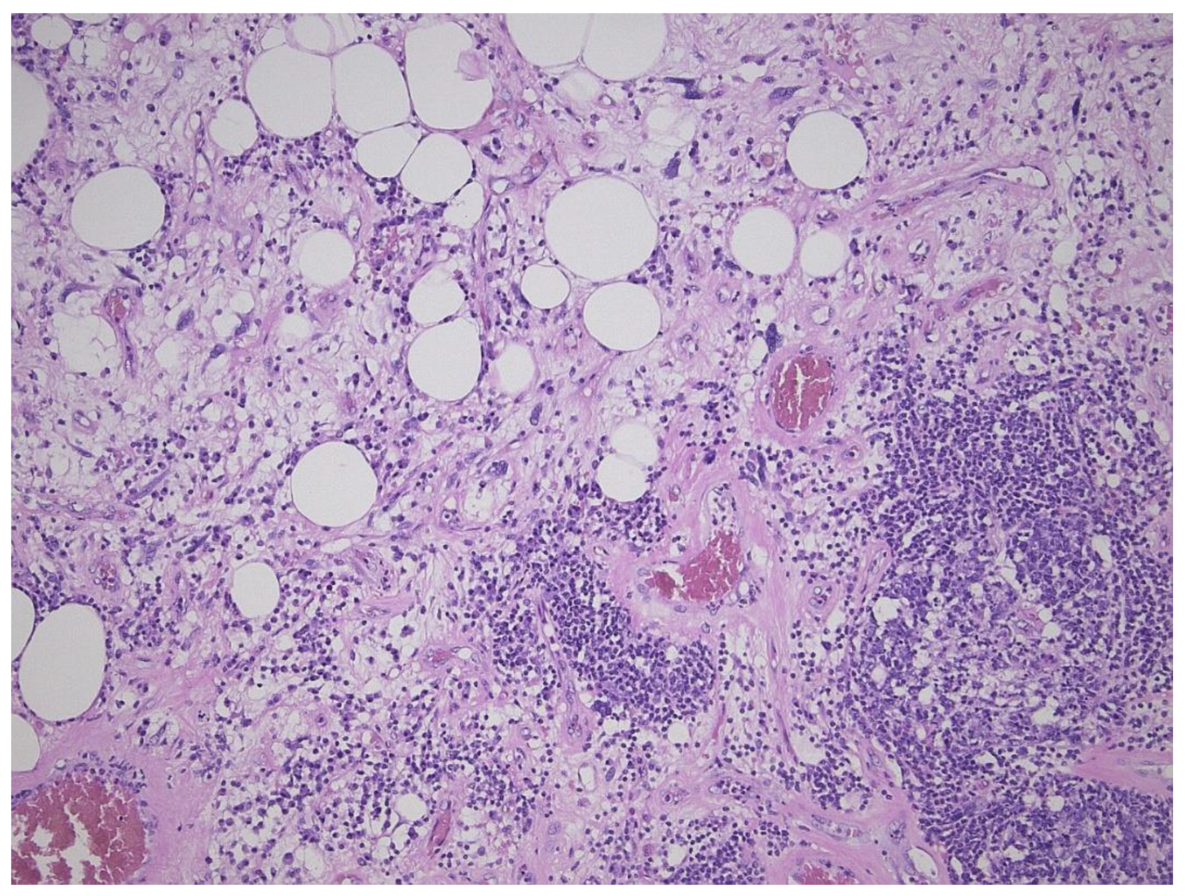 Diagnostics 11 00496 g003 Diagnostics 11 00496 g003