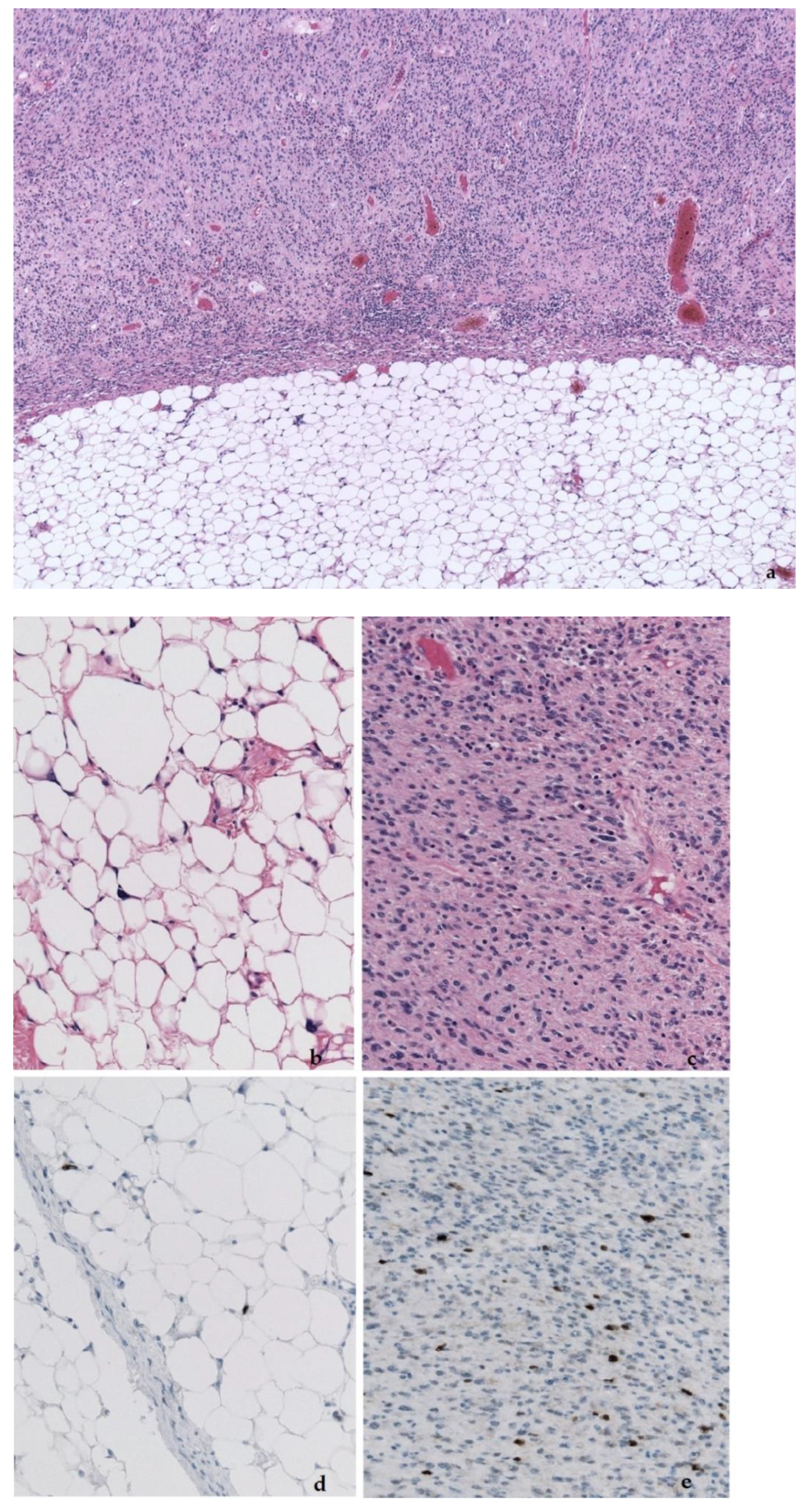 Diagnostics 11 00496 g007 Diagnostics 11 00496 g007