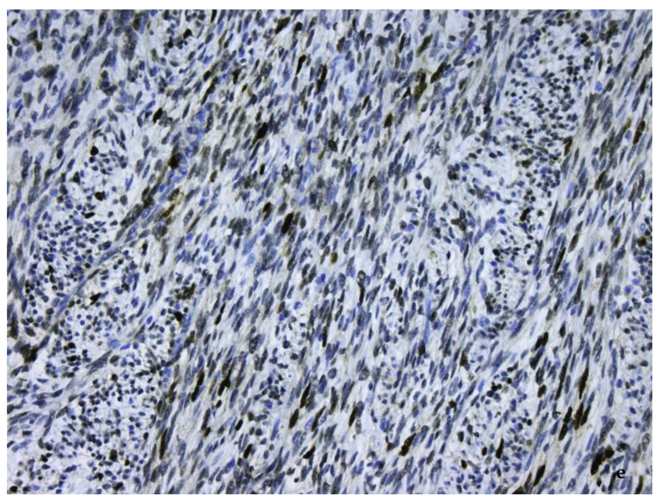 Diagnostics 11 00496 g010b Diagnostics 11 00496 g010b