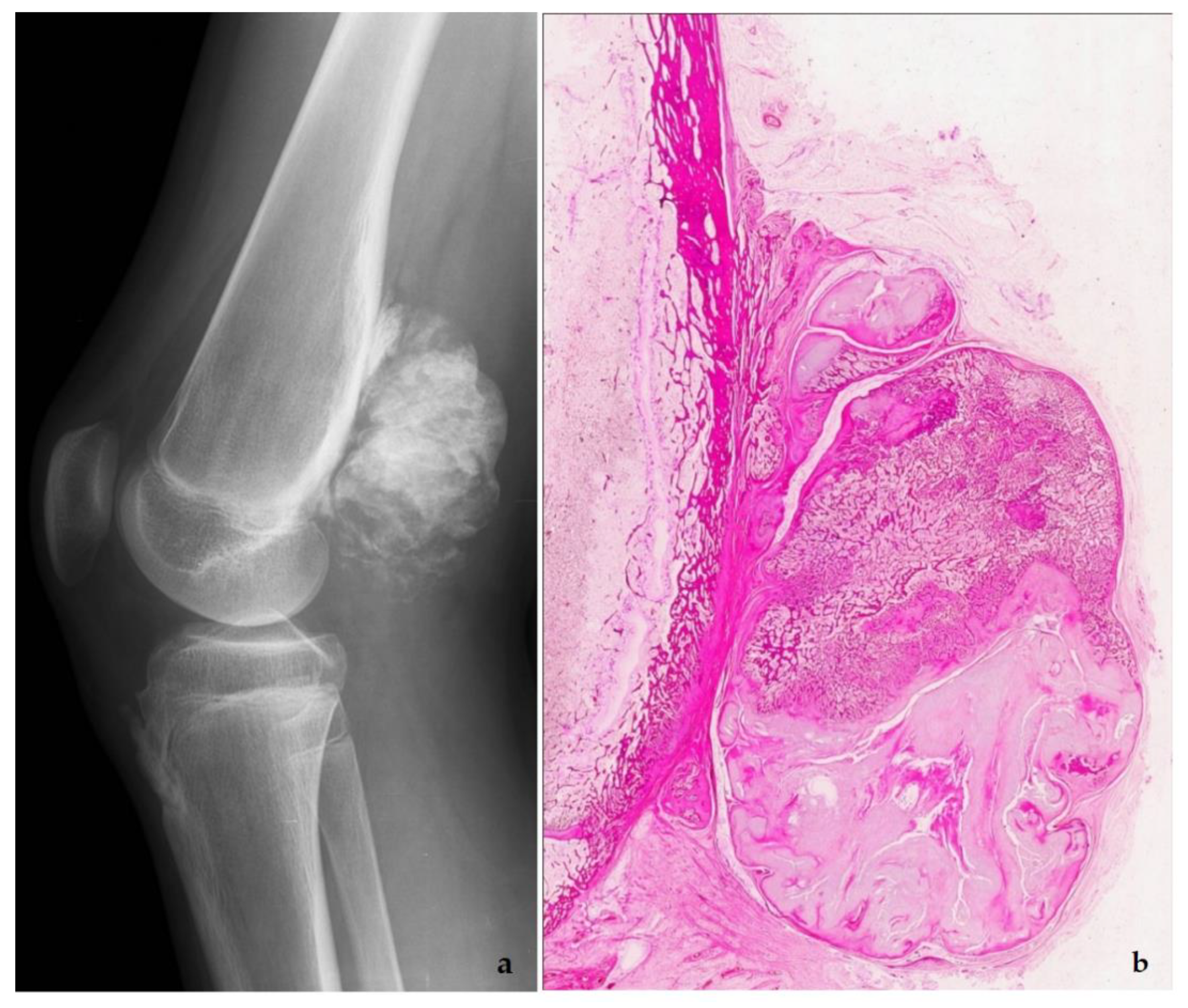 Diagnostics 11 00496 g011a Diagnostics 11 00496 g011a