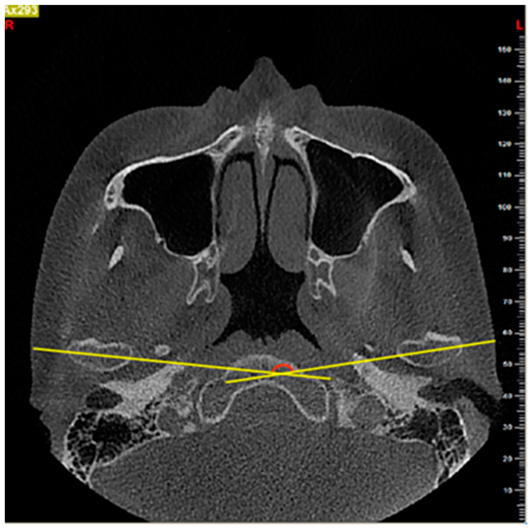 Diagnostics 11 00541 g002