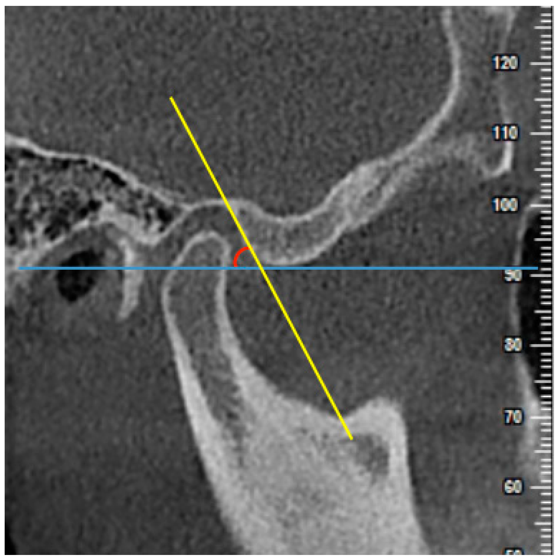 Diagnostics 11 00541 g003