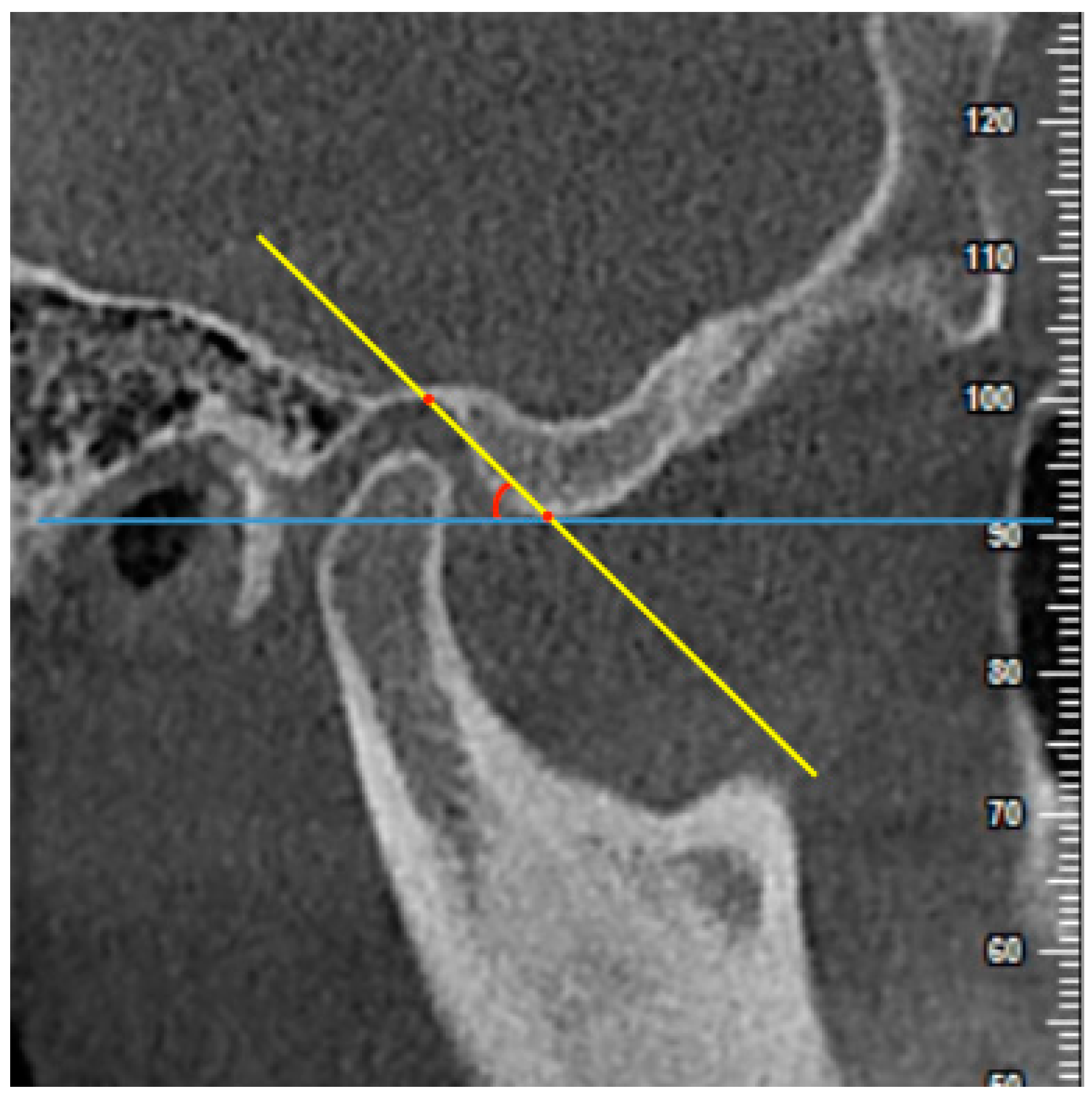Diagnostics 11 00541 g004