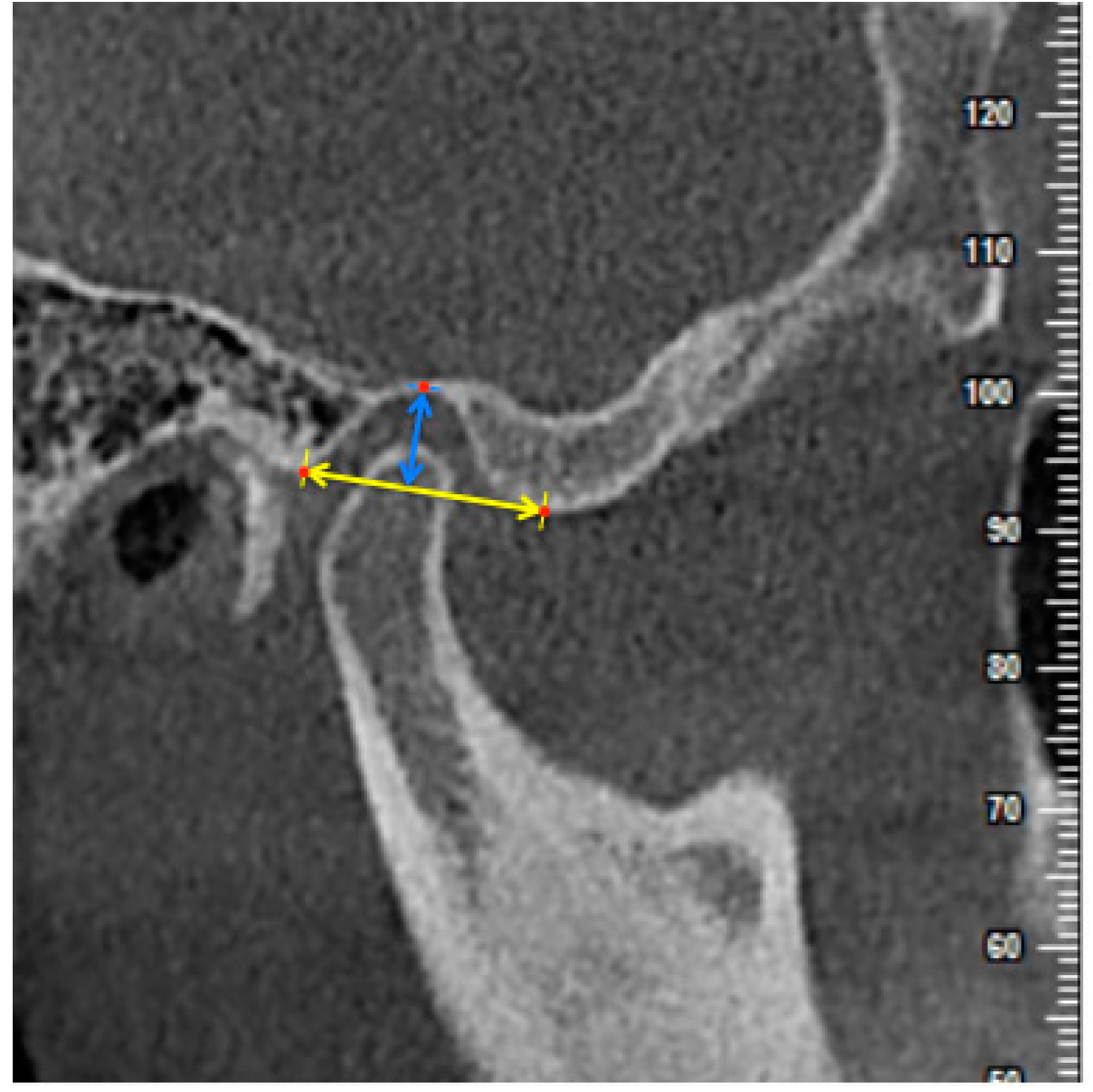 Diagnostics 11 00541 g005