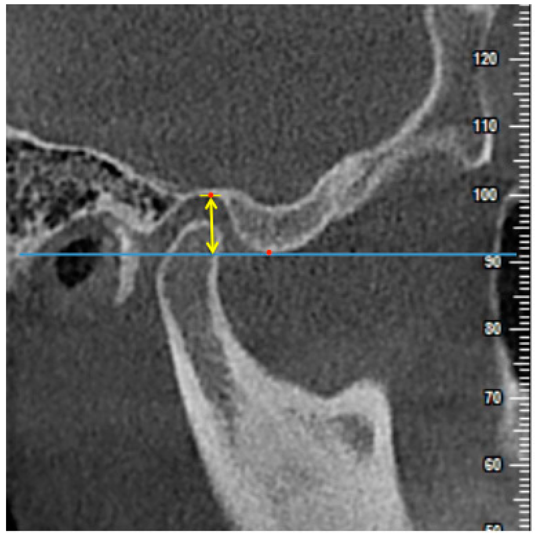 Diagnostics 11 00541 g006