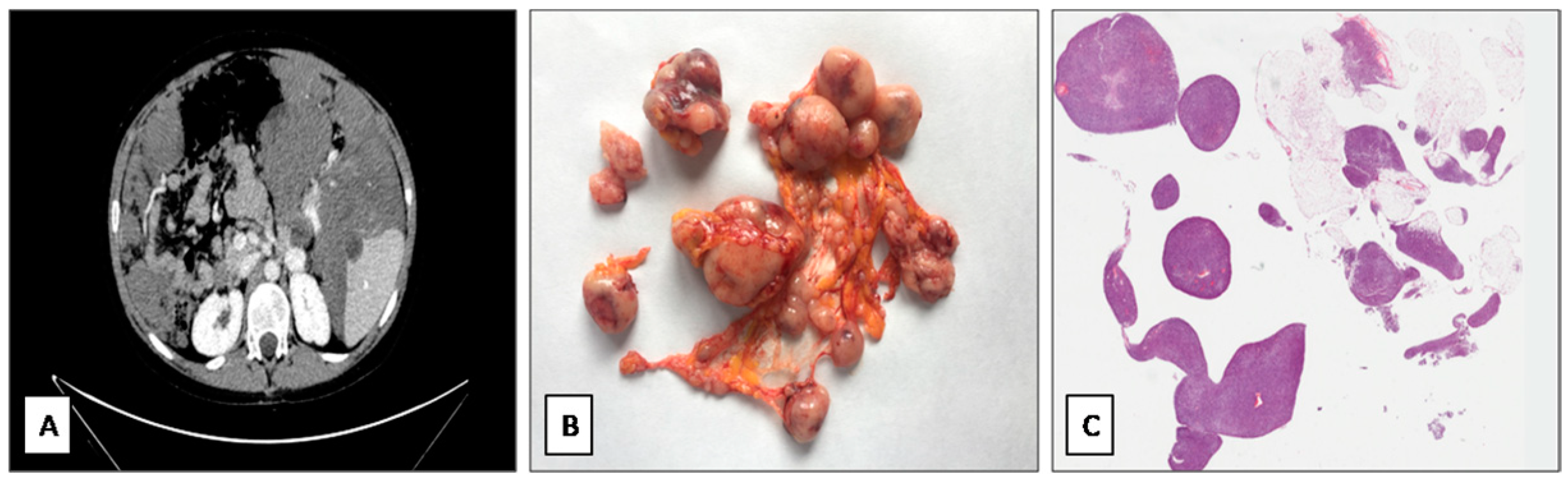 Diagnostics 11 00545 g001