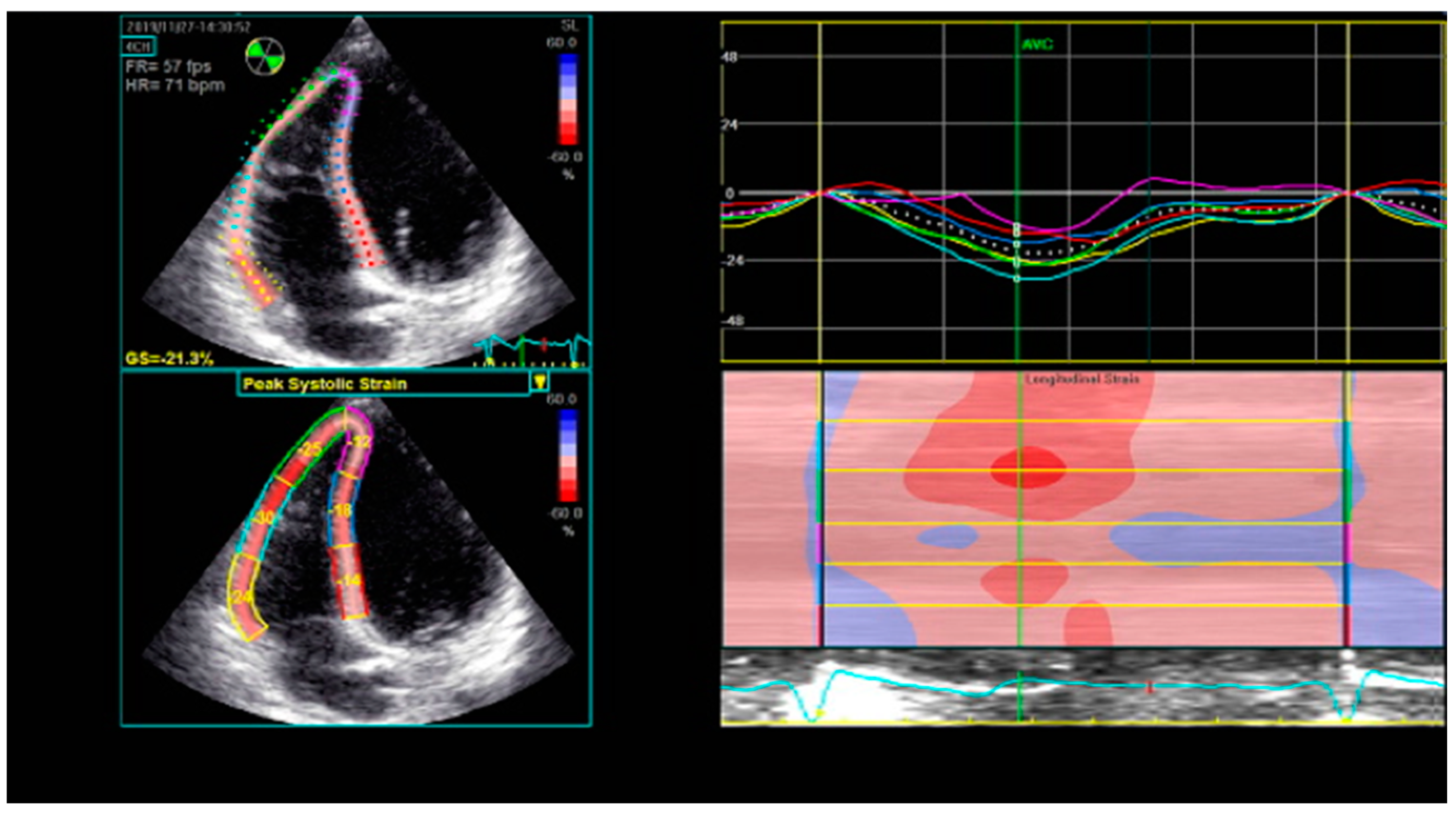 Diagnostics 11 00548 g003